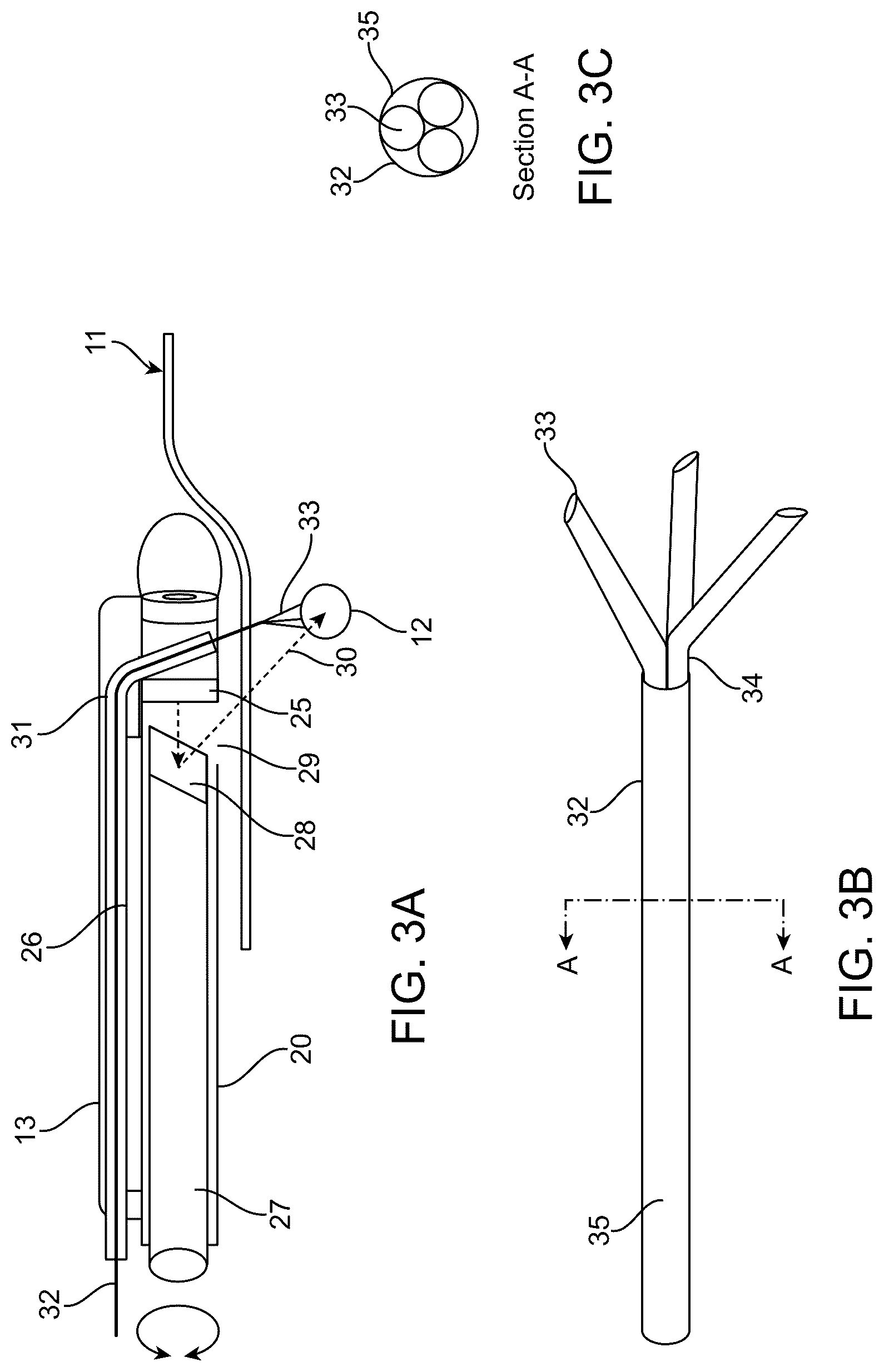 Patent US12318252 Figure 3 – Combined ultrasonic and direct visual hysteroscope