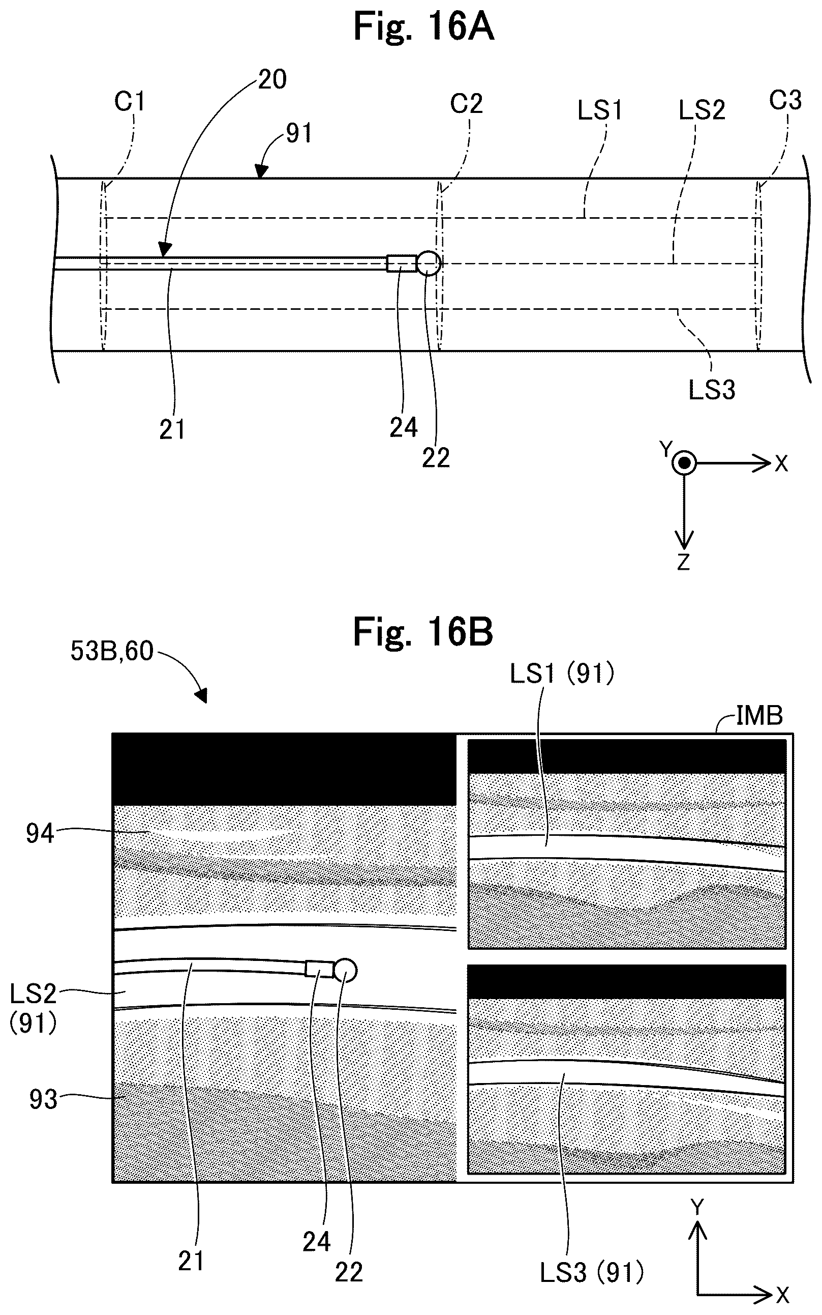 Patent US12318253 Figure 16 – Image display device and image display method
