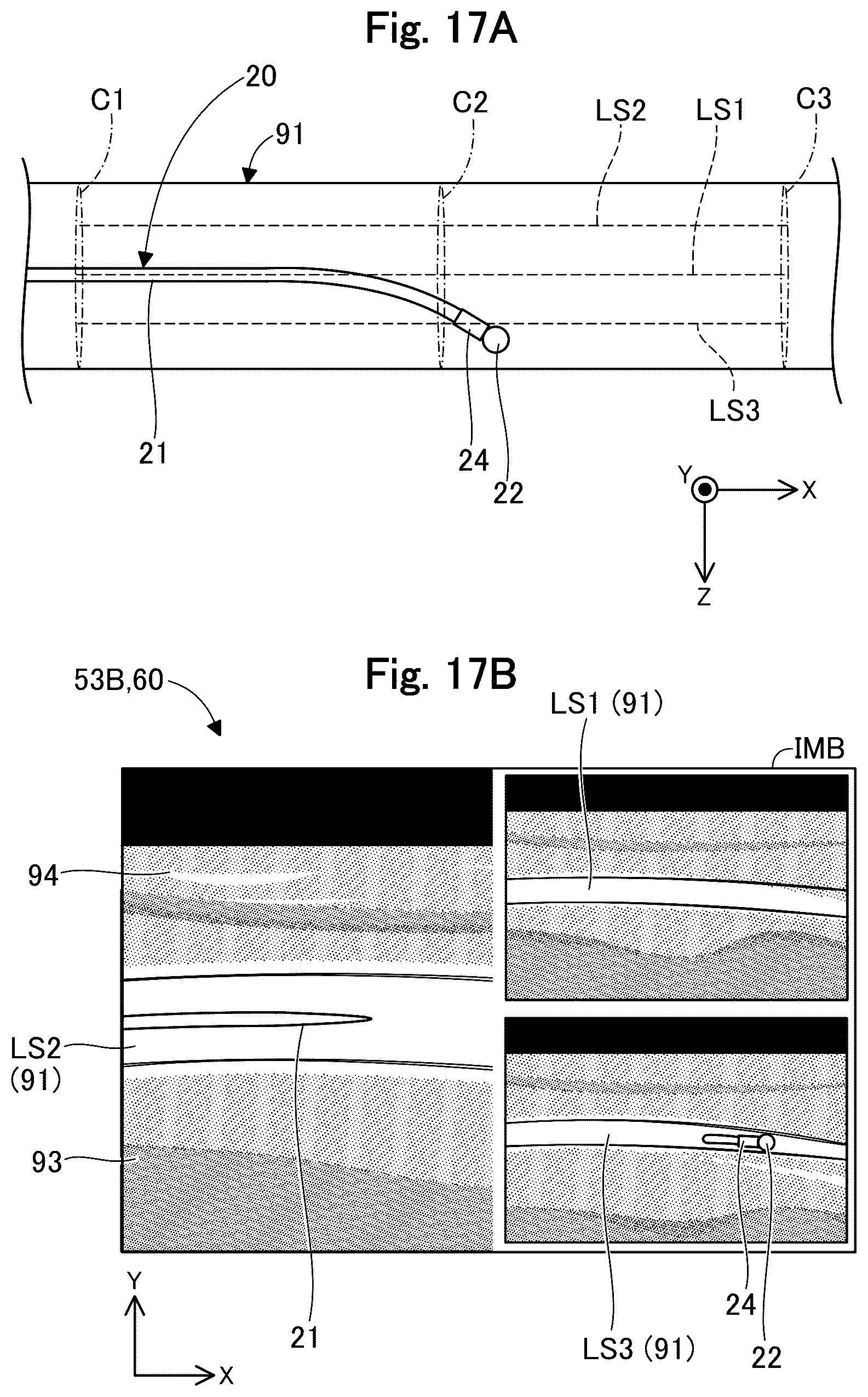 Patent US12318253 Figure 17 – Image display device and image display method