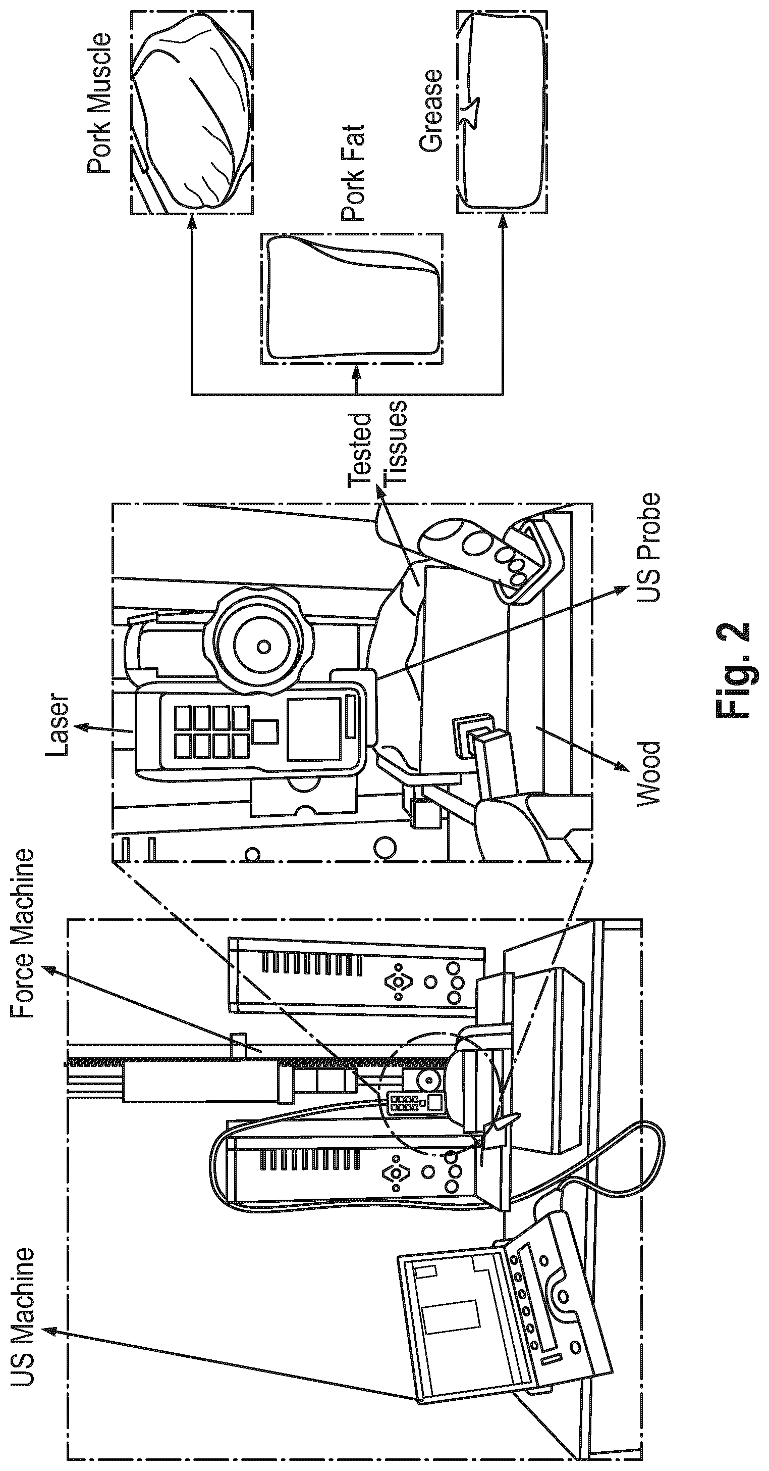 Patent US12318254 Figure 2 – Method and device for characterizing at least one object depicted in an ultrasound image