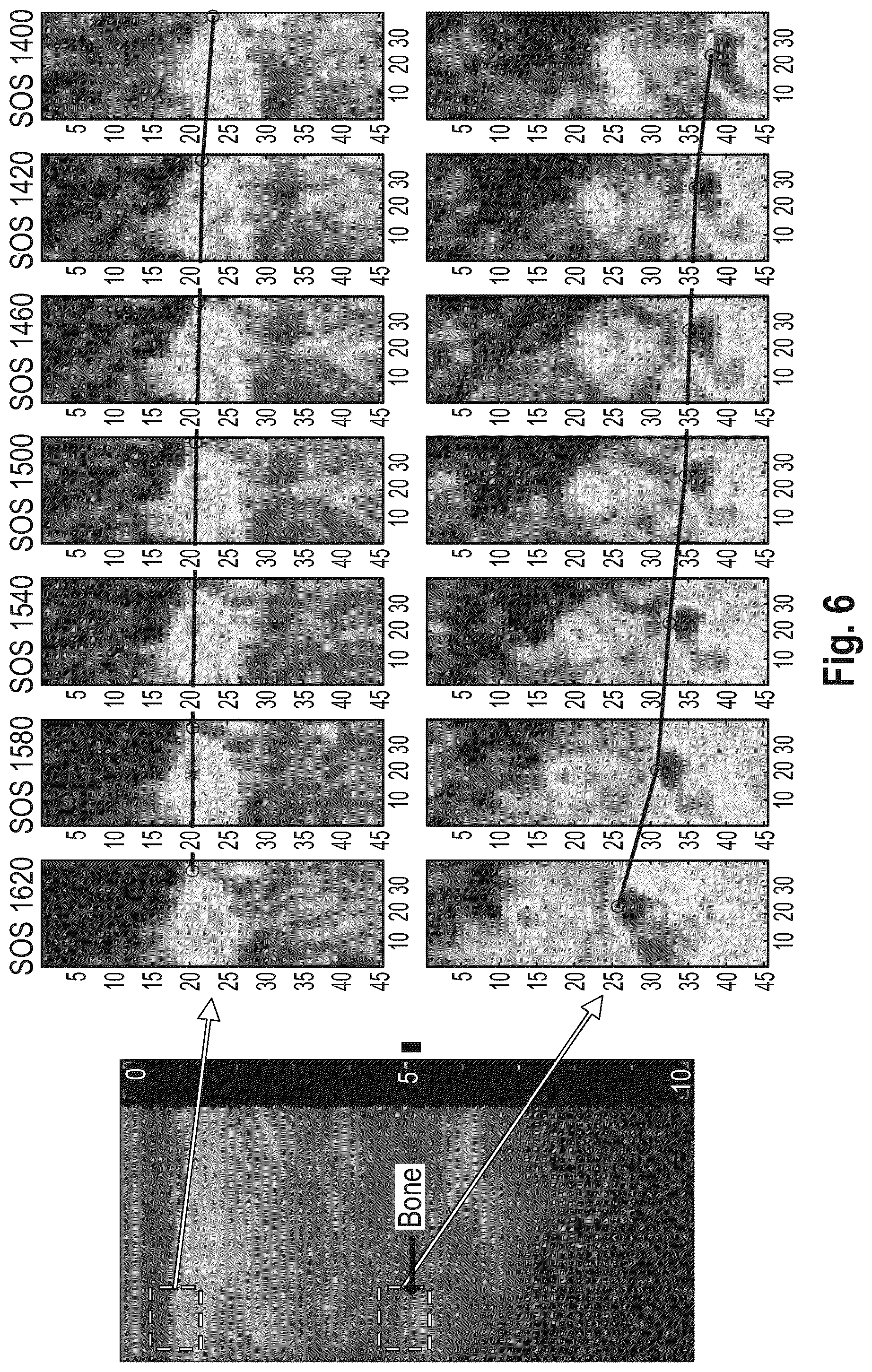 Patent US12318254 Figure 6 – Method and device for characterizing at least one object depicted in an ultrasound image