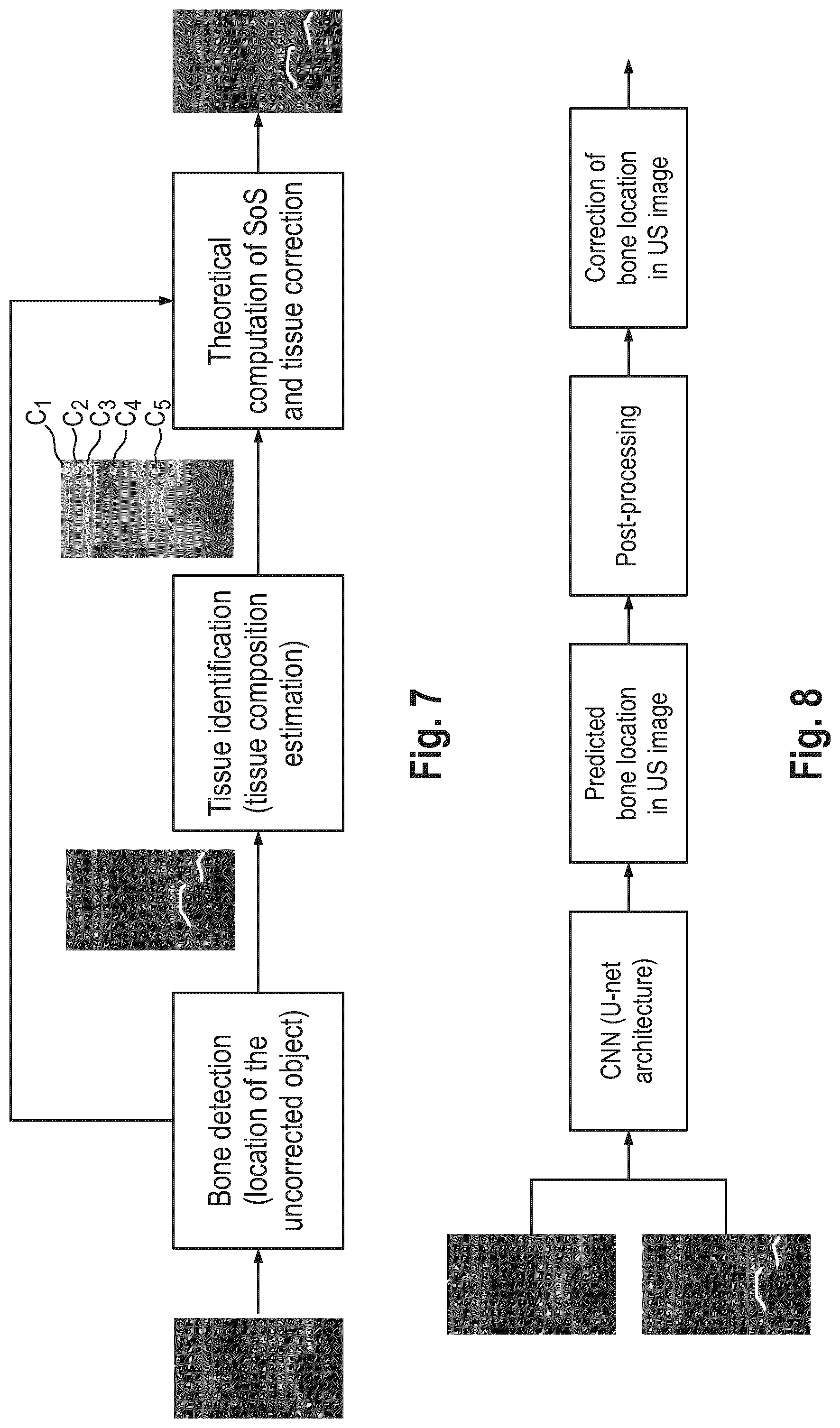 Patent US12318254 Figure 7 – Method and device for characterizing at least one object depicted in an ultrasound image