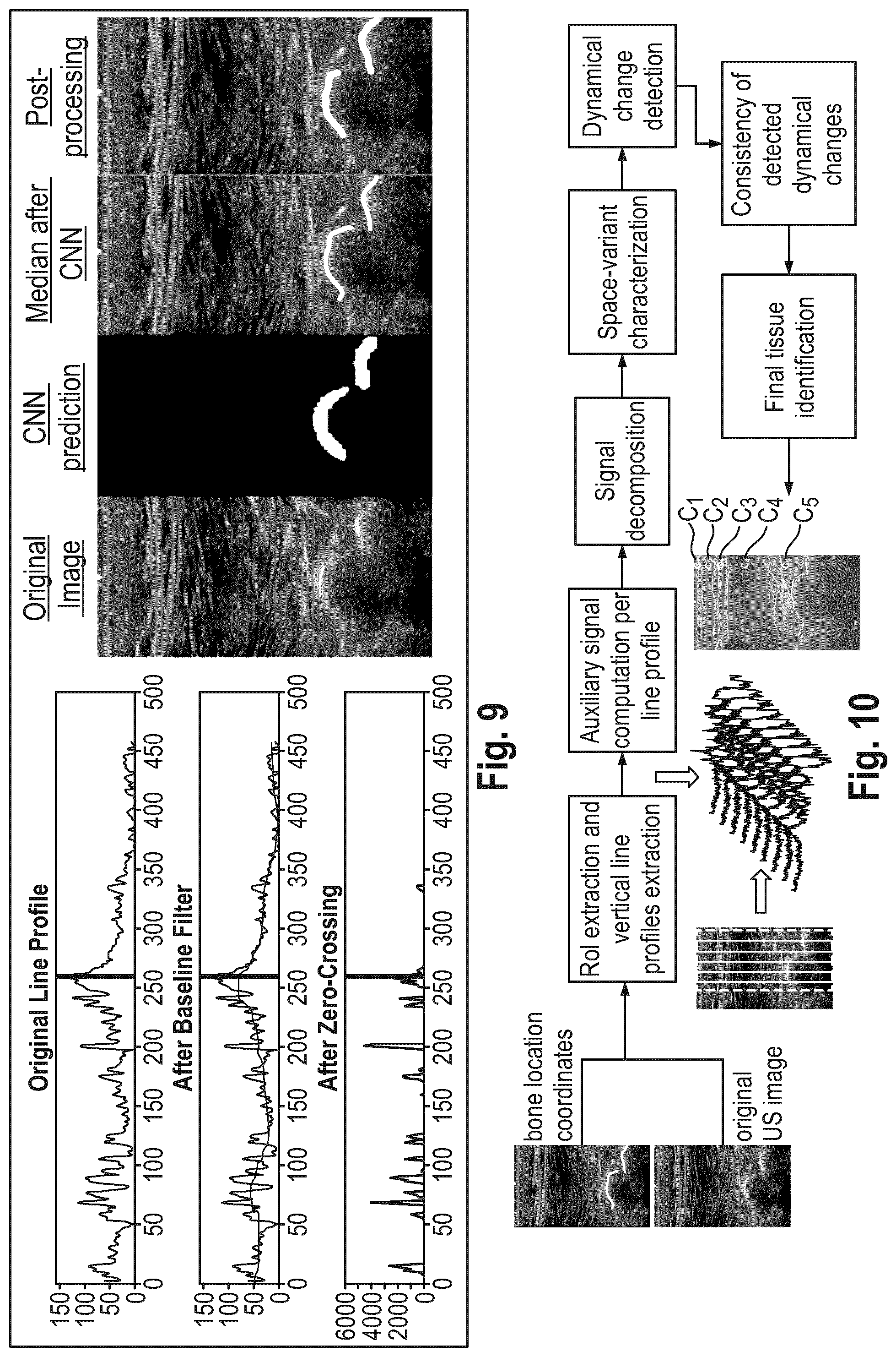 Patent US12318254 Figure 8 – Method and device for characterizing at least one object depicted in an ultrasound image