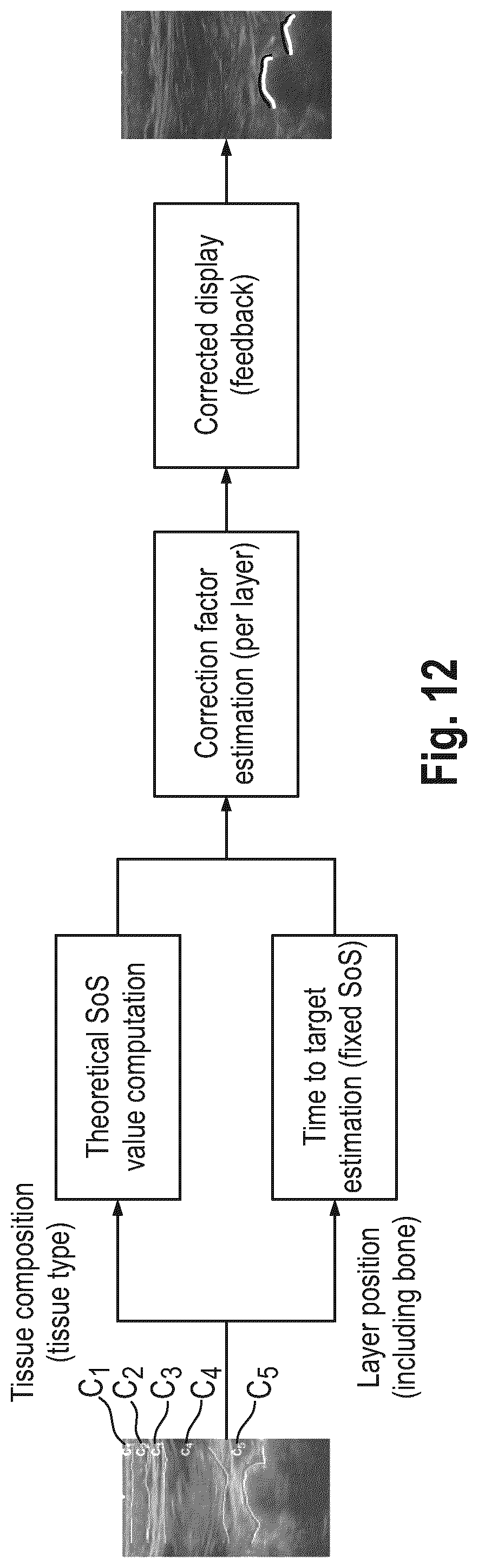 Patent US12318254 Figure 10 – Method and device for characterizing at least one object depicted in an ultrasound image