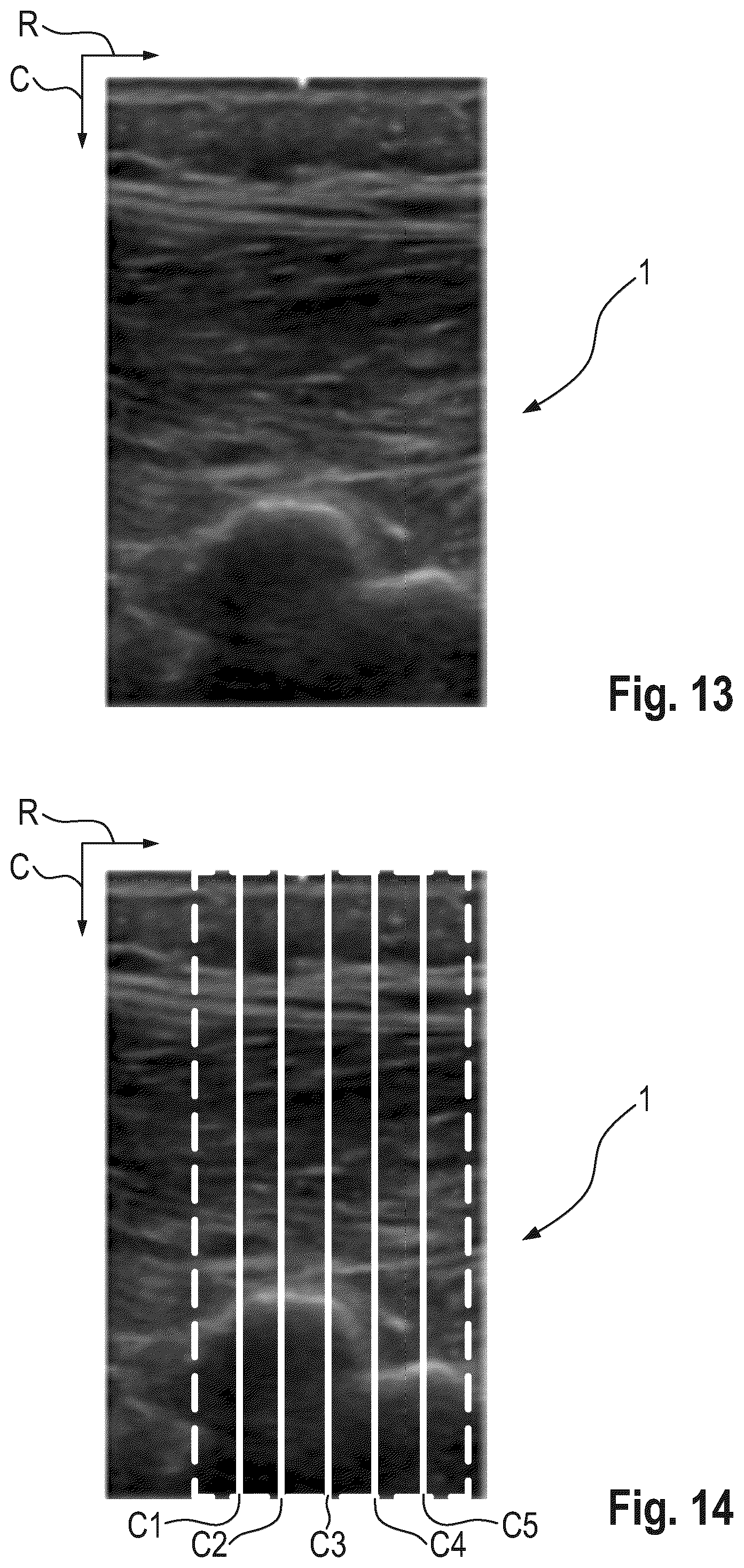 Patent US12318254 Figure 11 – Method and device for characterizing at least one object depicted in an ultrasound image