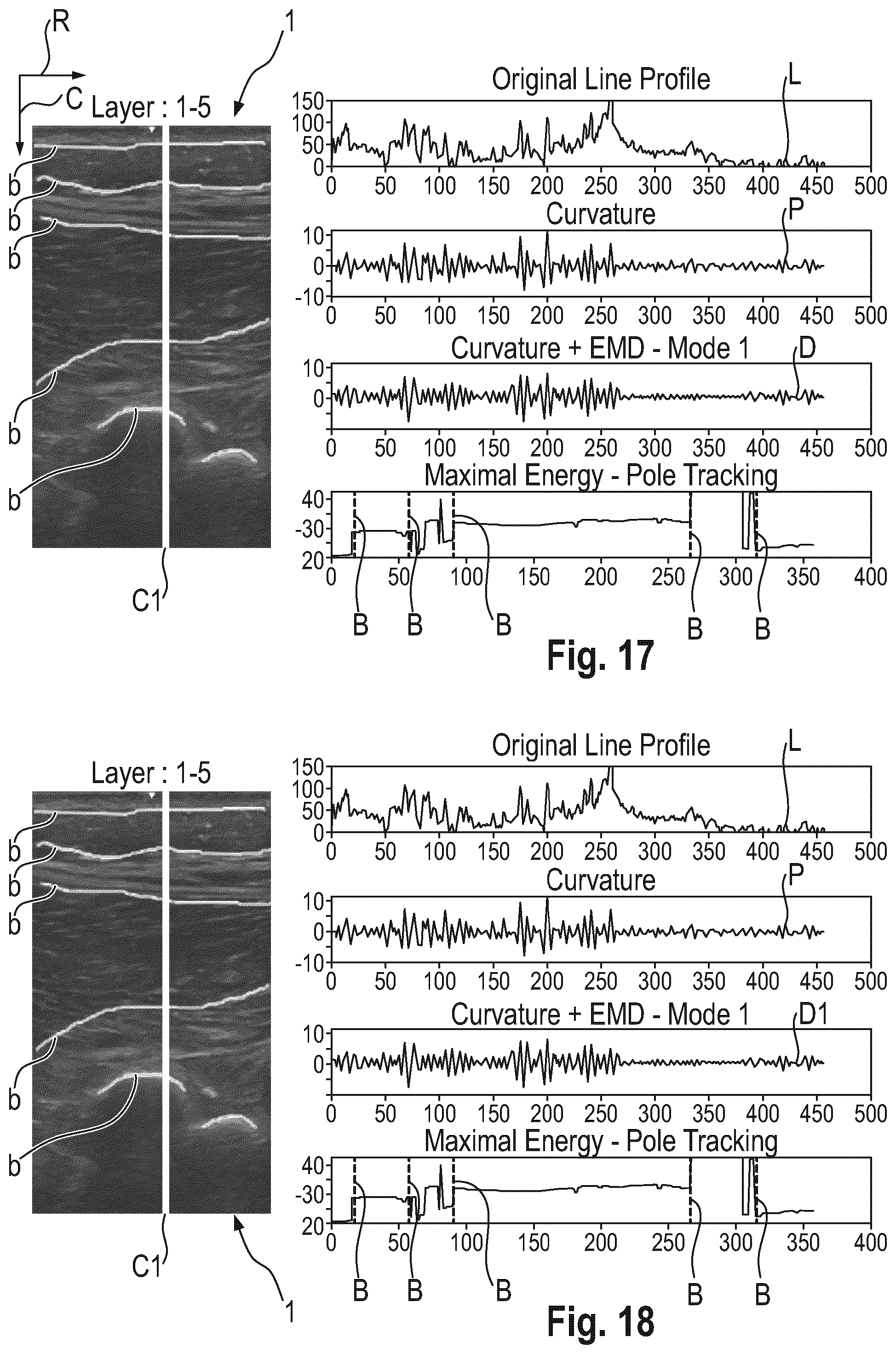 Patent US12318254 Figure 13 – Method and device for characterizing at least one object depicted in an ultrasound image
