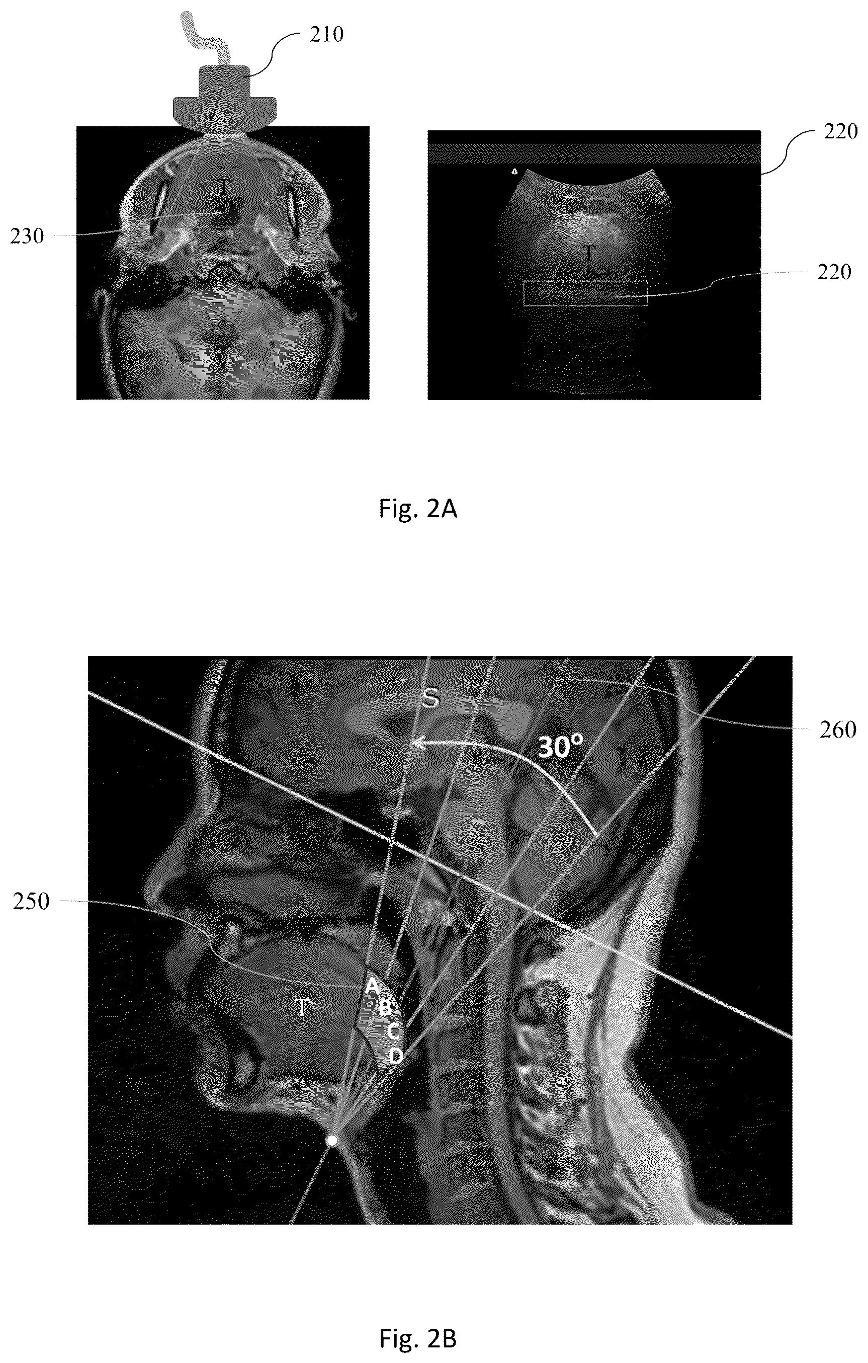Patent US12318255 Figure 2 – Methods for predicting the risk of obstructive sleep apnea