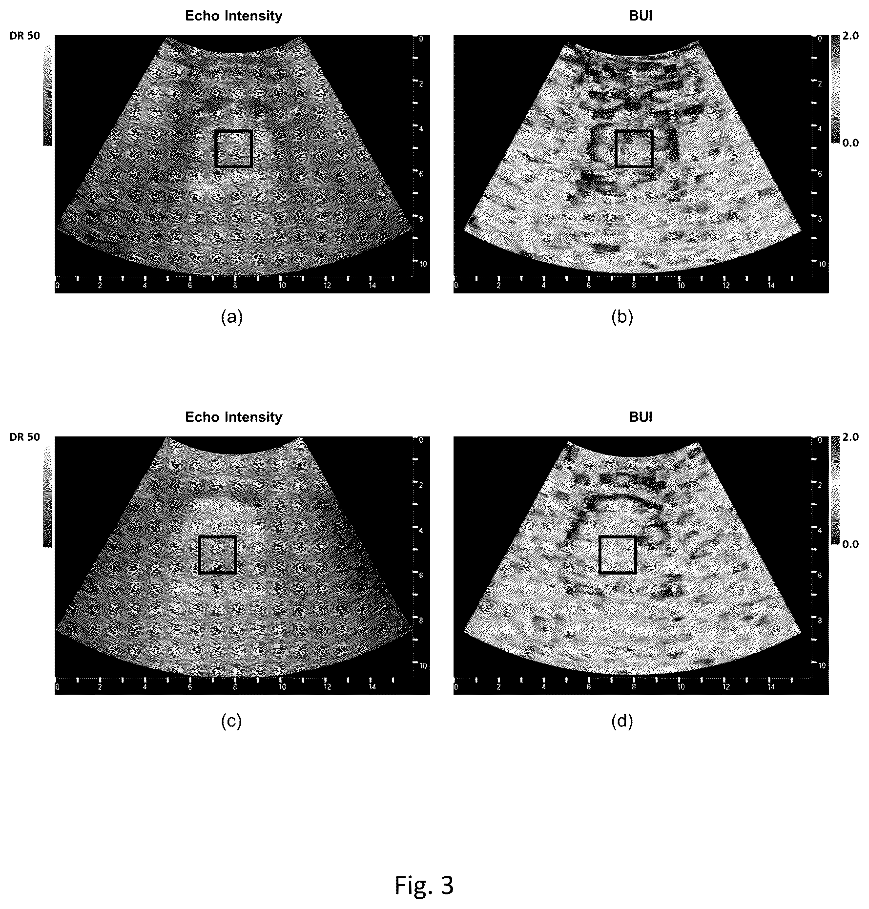 Patent US12318255 Figure 4 – Methods for predicting the risk of obstructive sleep apnea
