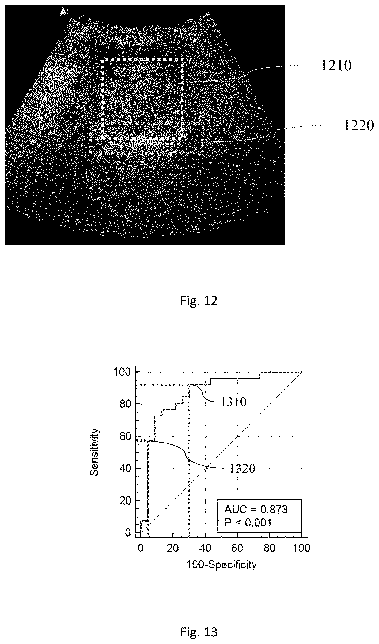 Patent US12318255 Figure 12 – Methods for predicting the risk of obstructive sleep apnea