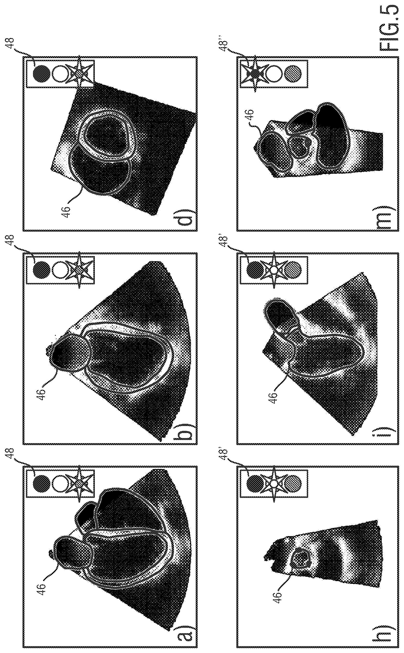 Patent US12318256 Figure 5 – 3D ultrasound imaging system