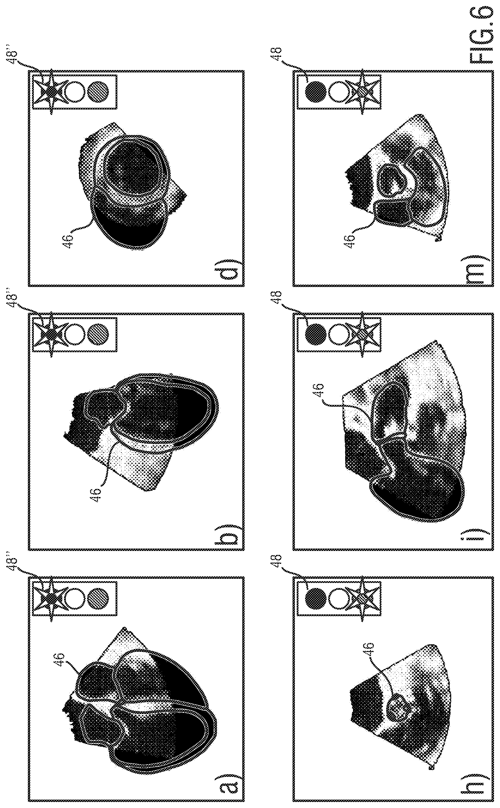Patent US12318256 Figure 6 – 3D ultrasound imaging system