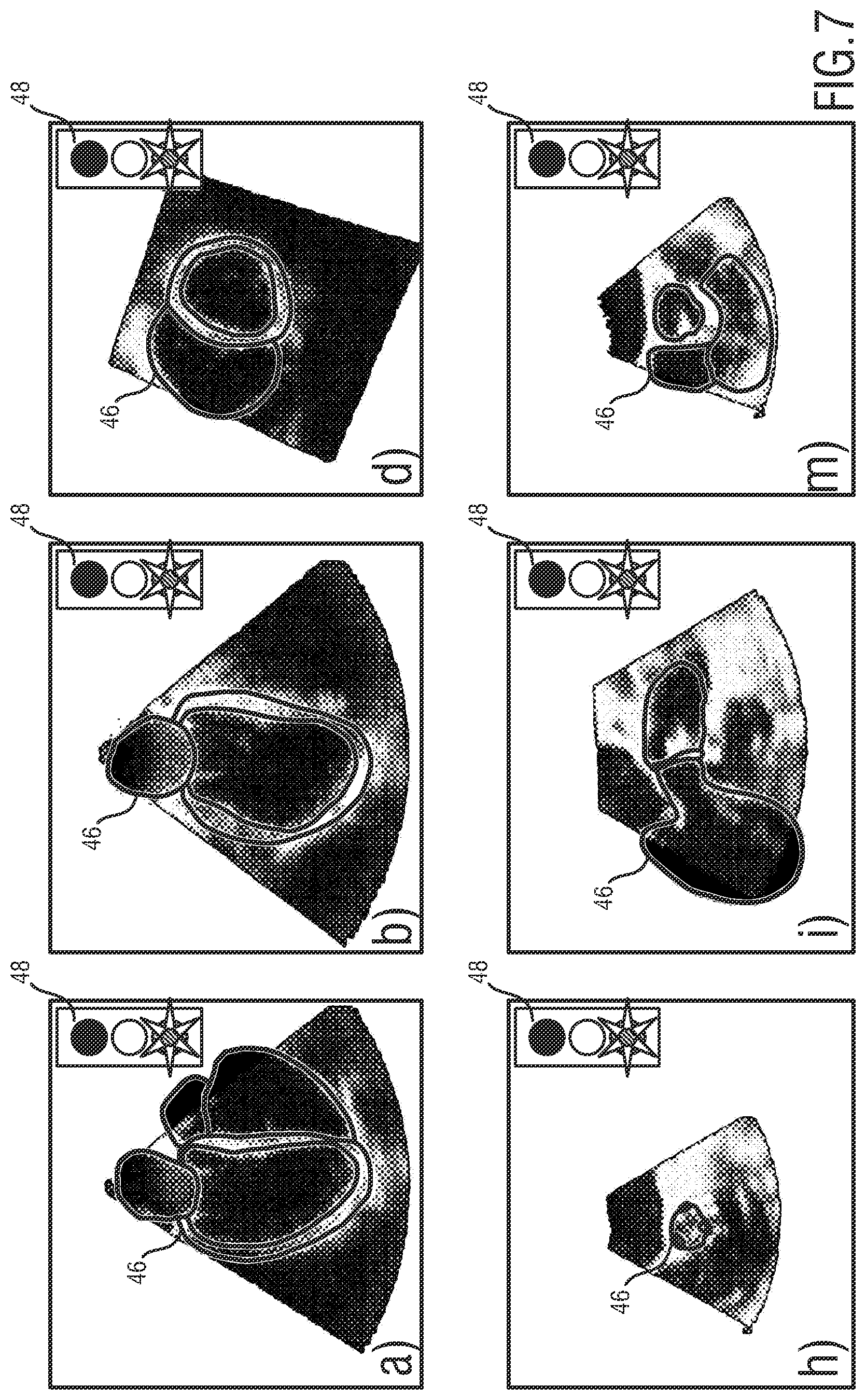 Patent US12318256 Figure 7 – 3D ultrasound imaging system