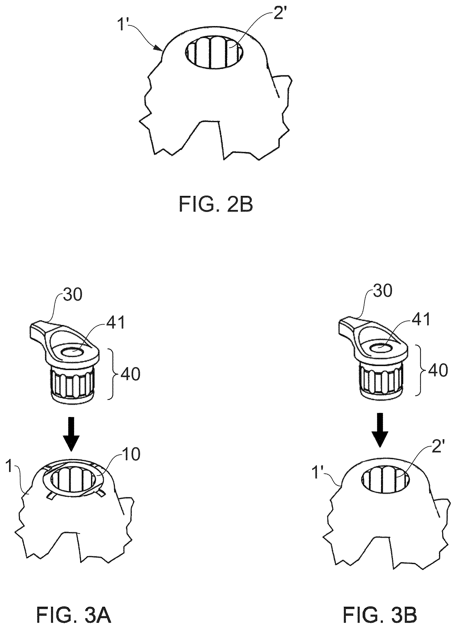 Patent US12318258 Figure 2 – Dental drill guiding system