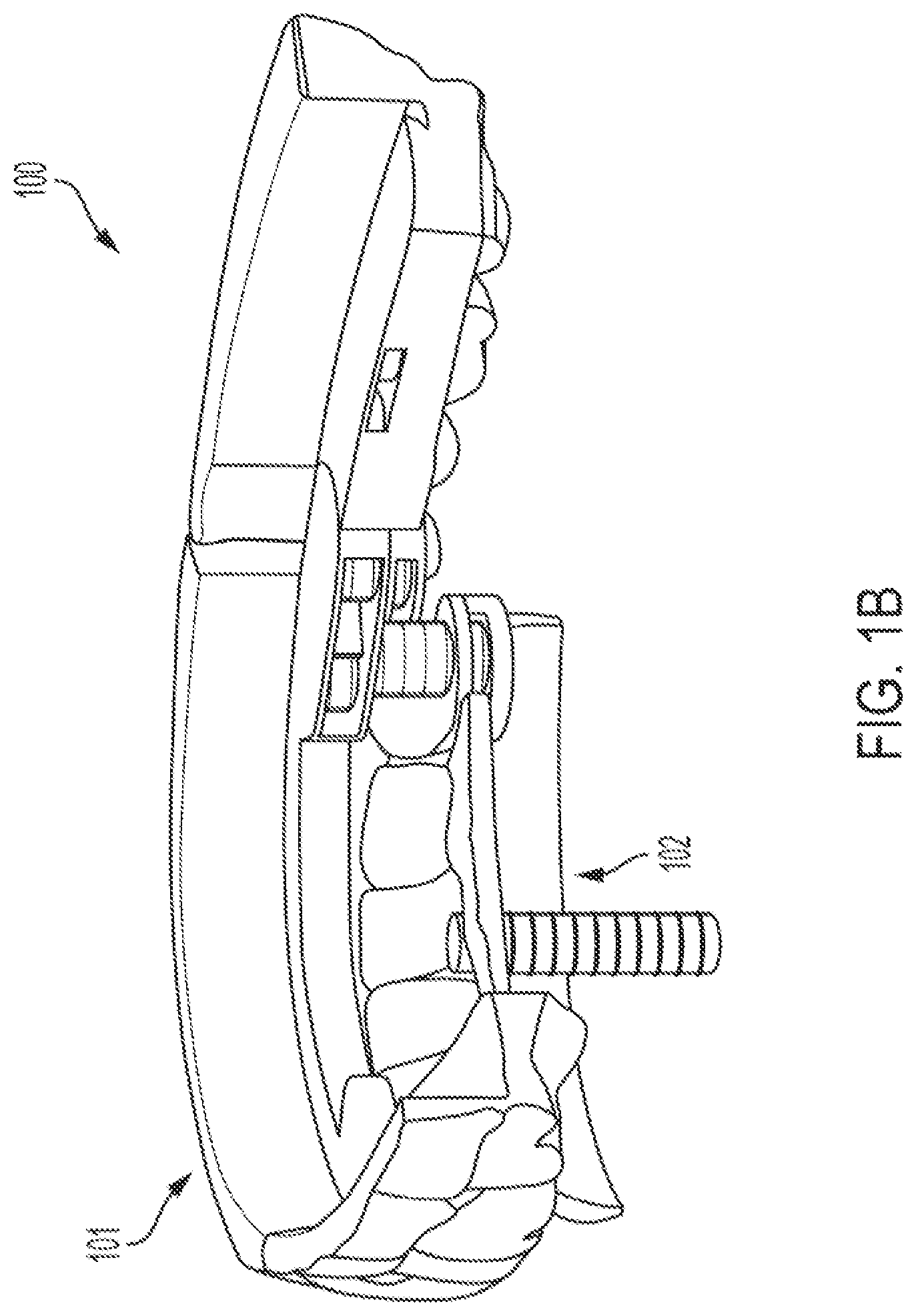 Patent US12318260 Figure 2 – Assembly for locating and verifying the anatomic position of a full-arch dental prosthetics