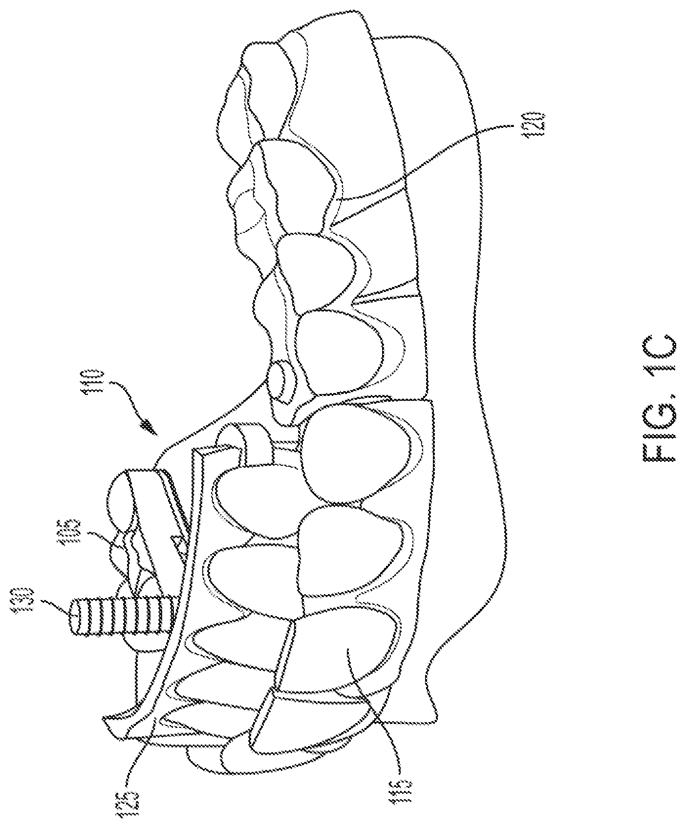 Patent US12318260 Figure 3 – Assembly for locating and verifying the anatomic position of a full-arch dental prosthetics
