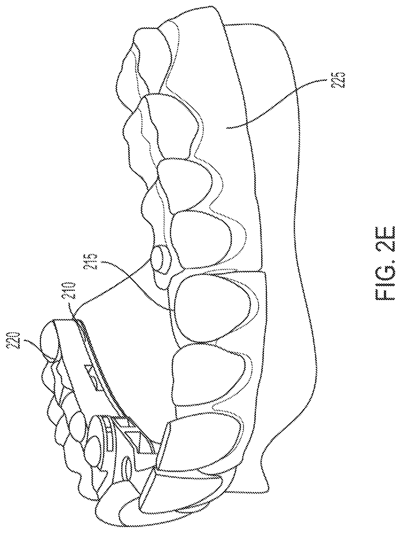 Patent US12318260 Figure 8 – Assembly for locating and verifying the anatomic position of a full-arch dental prosthetics