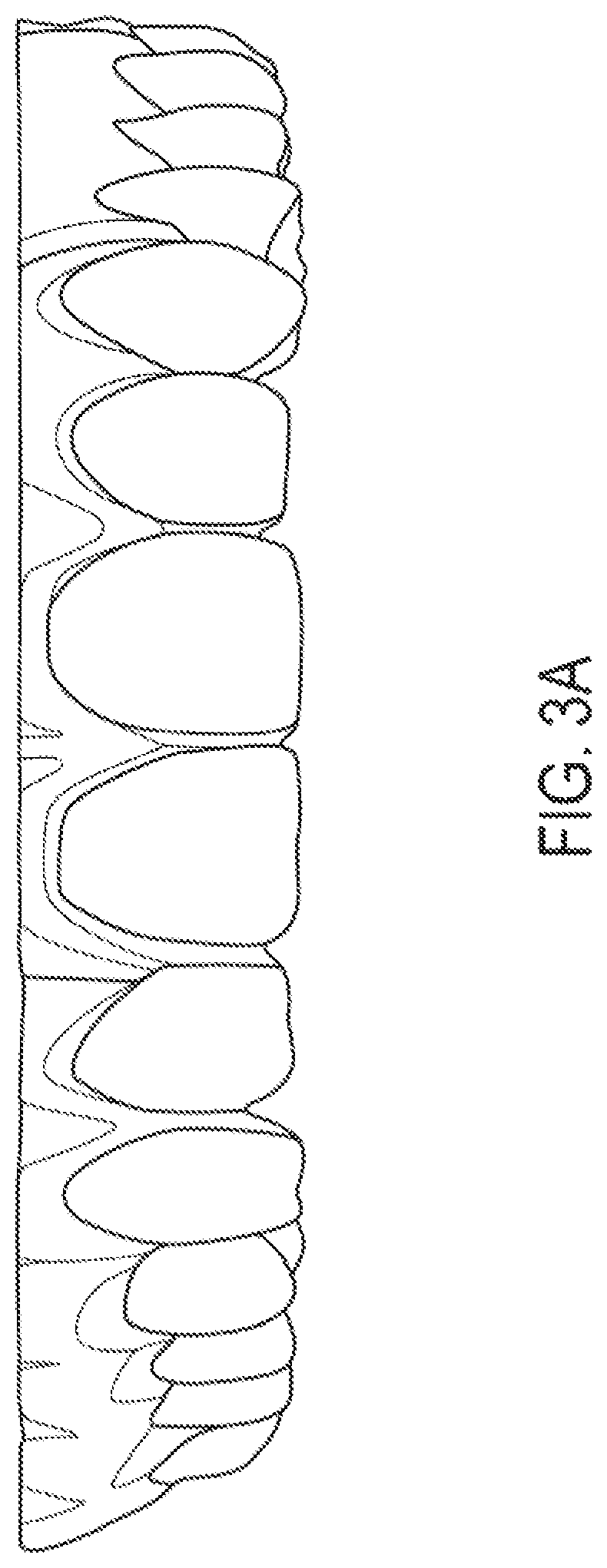 Patent US12318260 Figure 9 – Assembly for locating and verifying the anatomic position of a full-arch dental prosthetics