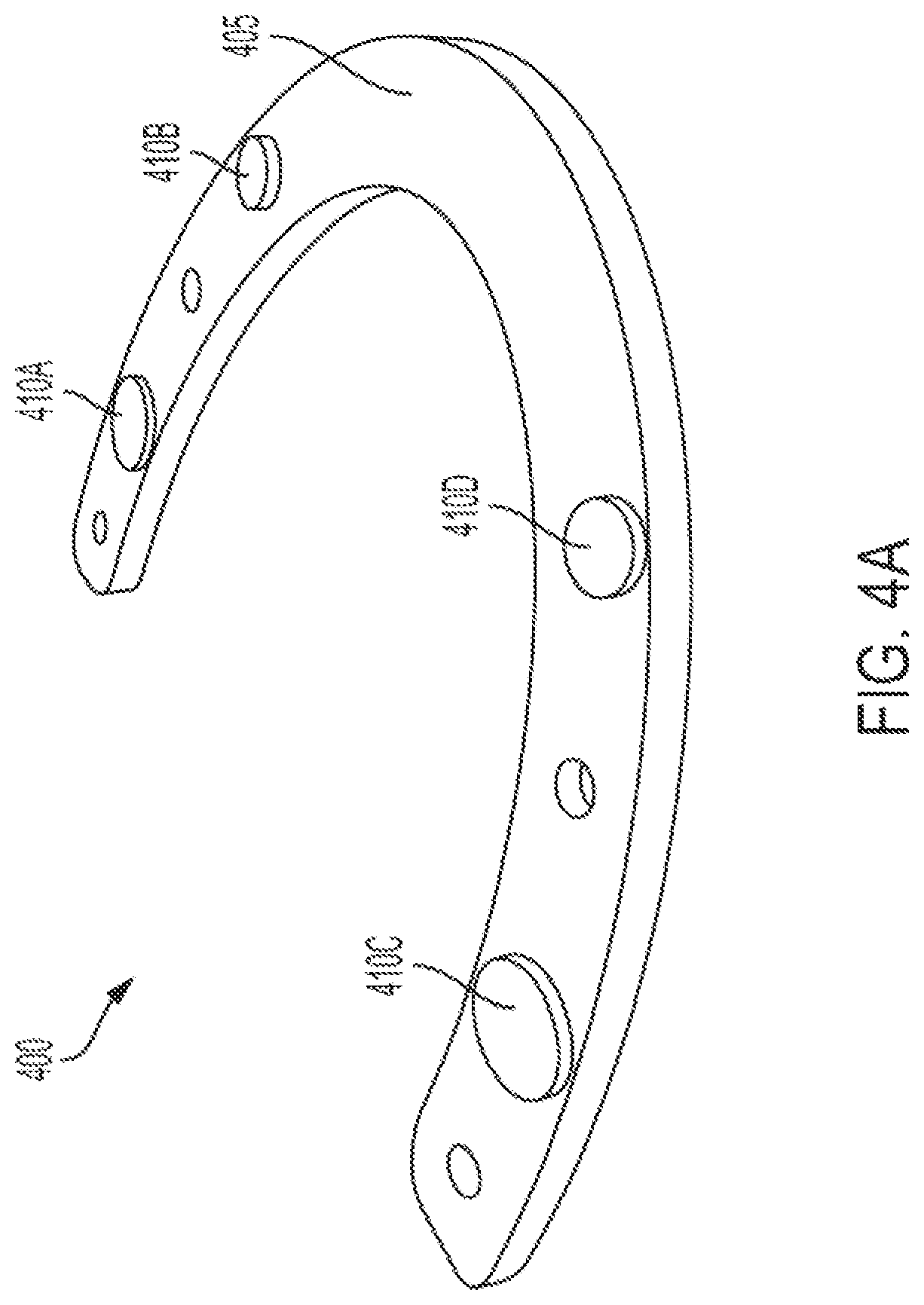 Patent US12318260 Figure 11 – Assembly for locating and verifying the anatomic position of a full-arch dental prosthetics
