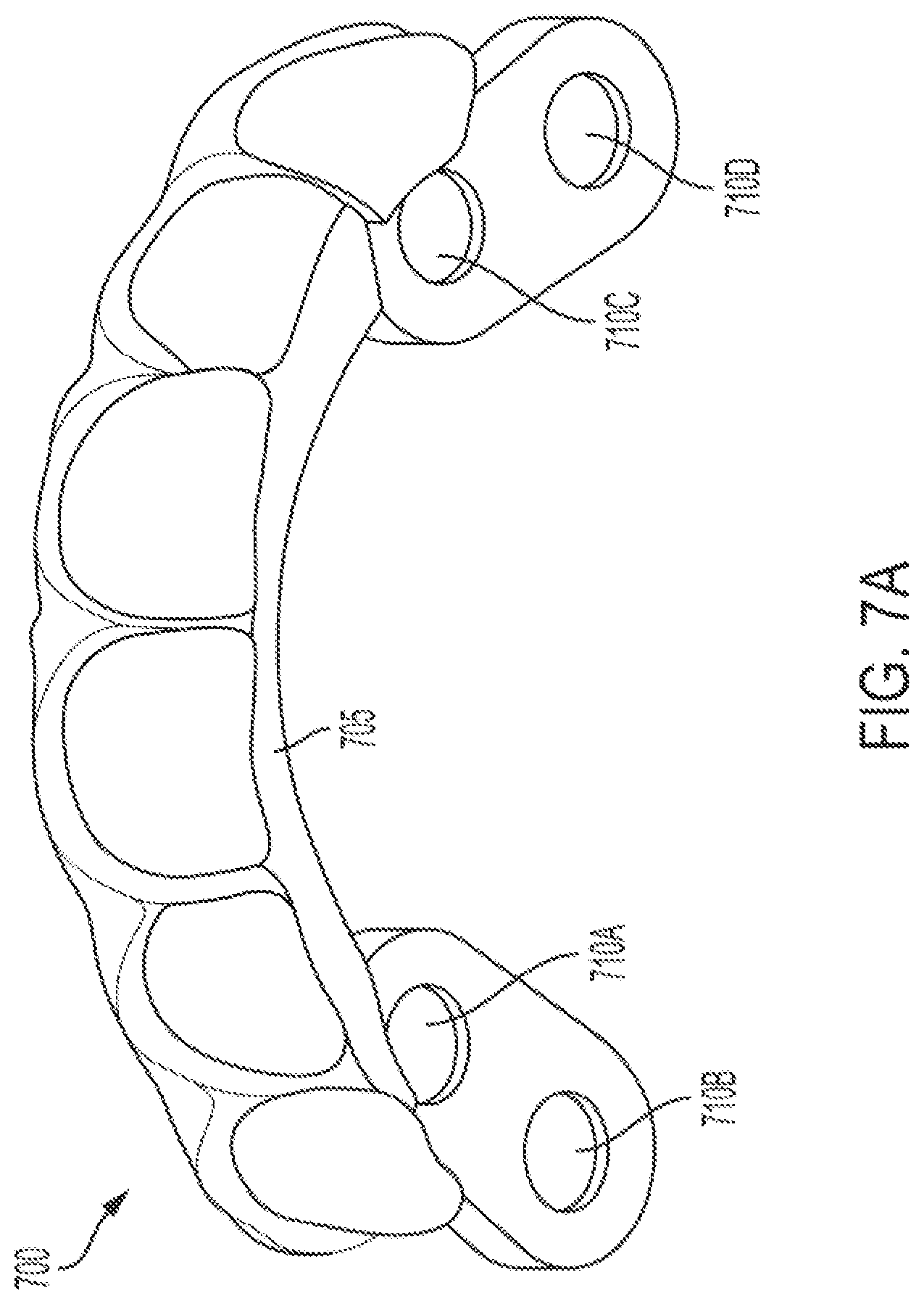 Patent US12318260 Figure 17 – Assembly for locating and verifying the anatomic position of a full-arch dental prosthetics