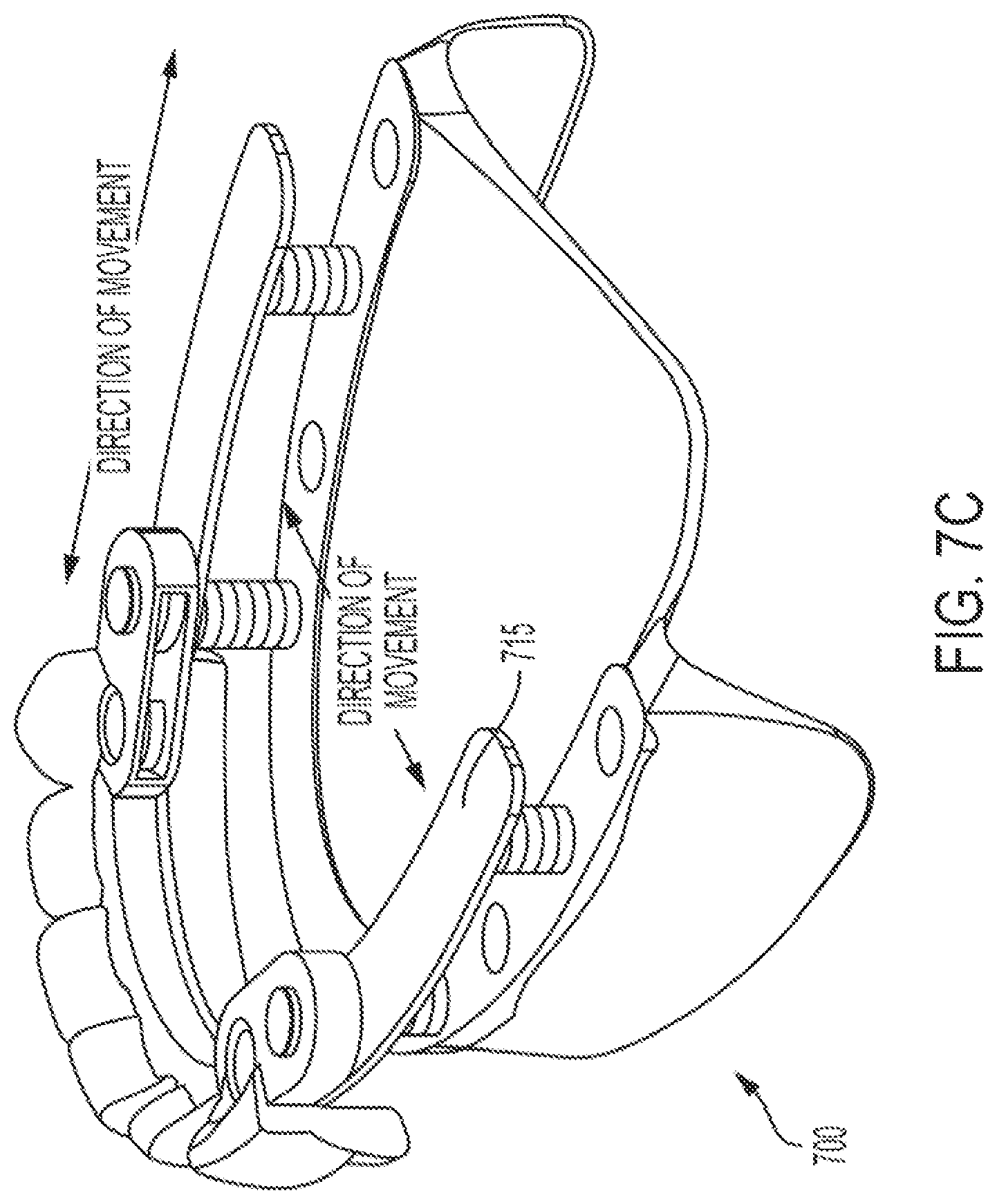 Patent US12318260 Figure 19 – Assembly for locating and verifying the anatomic position of a full-arch dental prosthetics