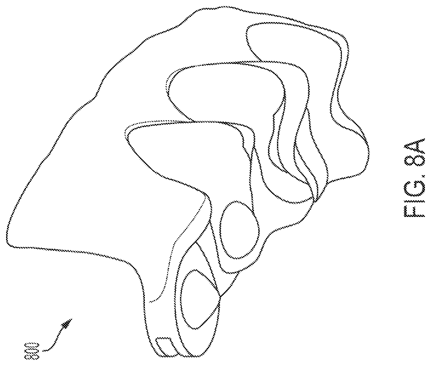 Patent US12318260 Figure 20 – Assembly for locating and verifying the anatomic position of a full-arch dental prosthetics