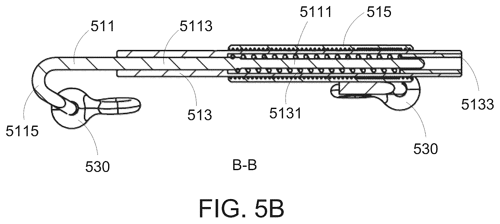 Patent US12318262 Figure 4 – Force applying device for orthodontic treatment