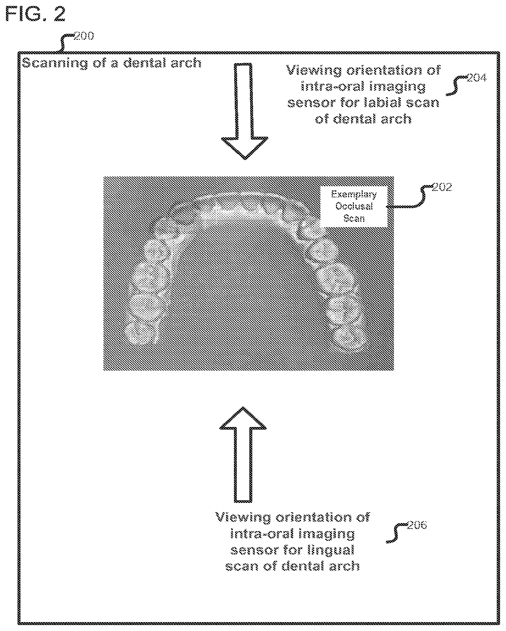 Patent US12318267 Figure 2 – Scanning sequence for an intra-oral imaging system