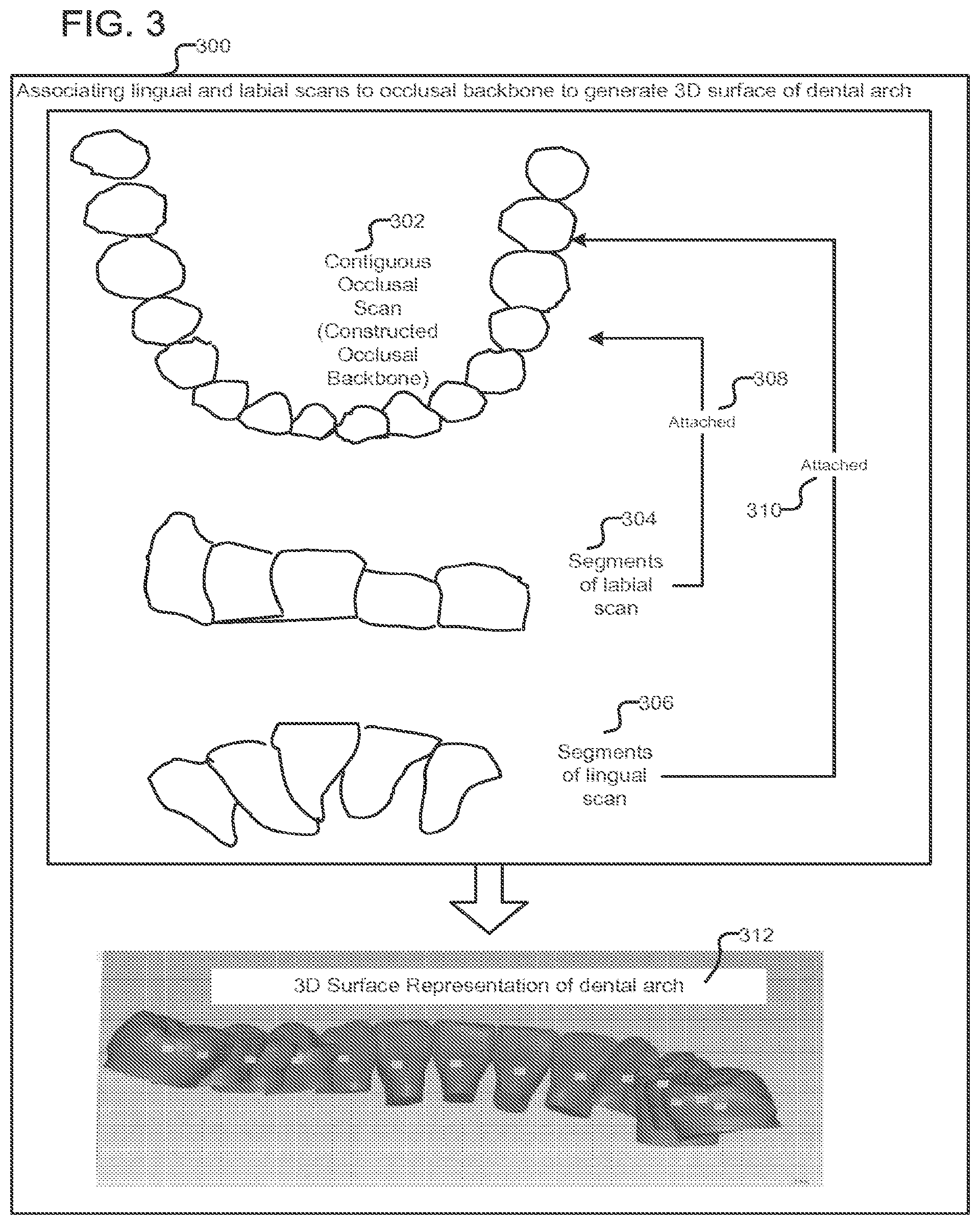 Patent US12318267 Figure 3 – Scanning sequence for an intra-oral imaging system
