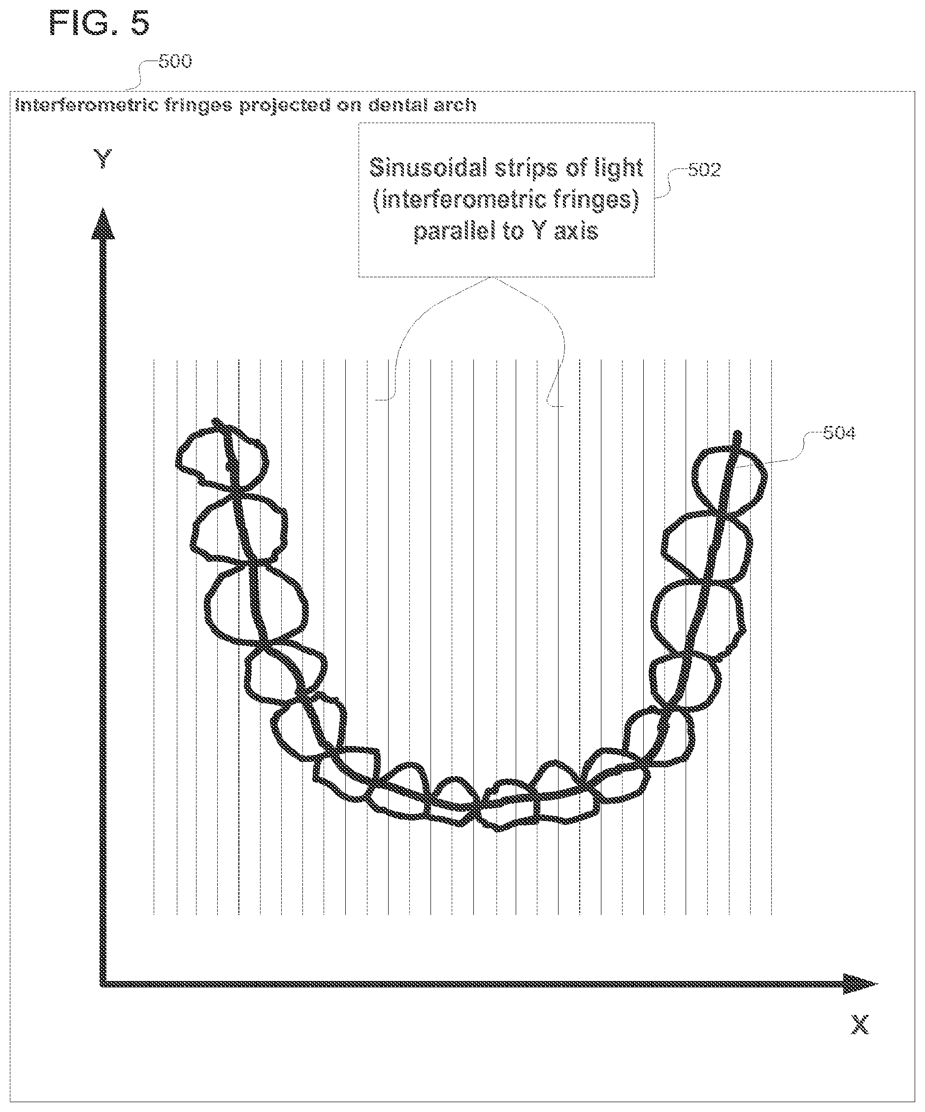 Patent US12318267 Figure 5 – Scanning sequence for an intra-oral imaging system