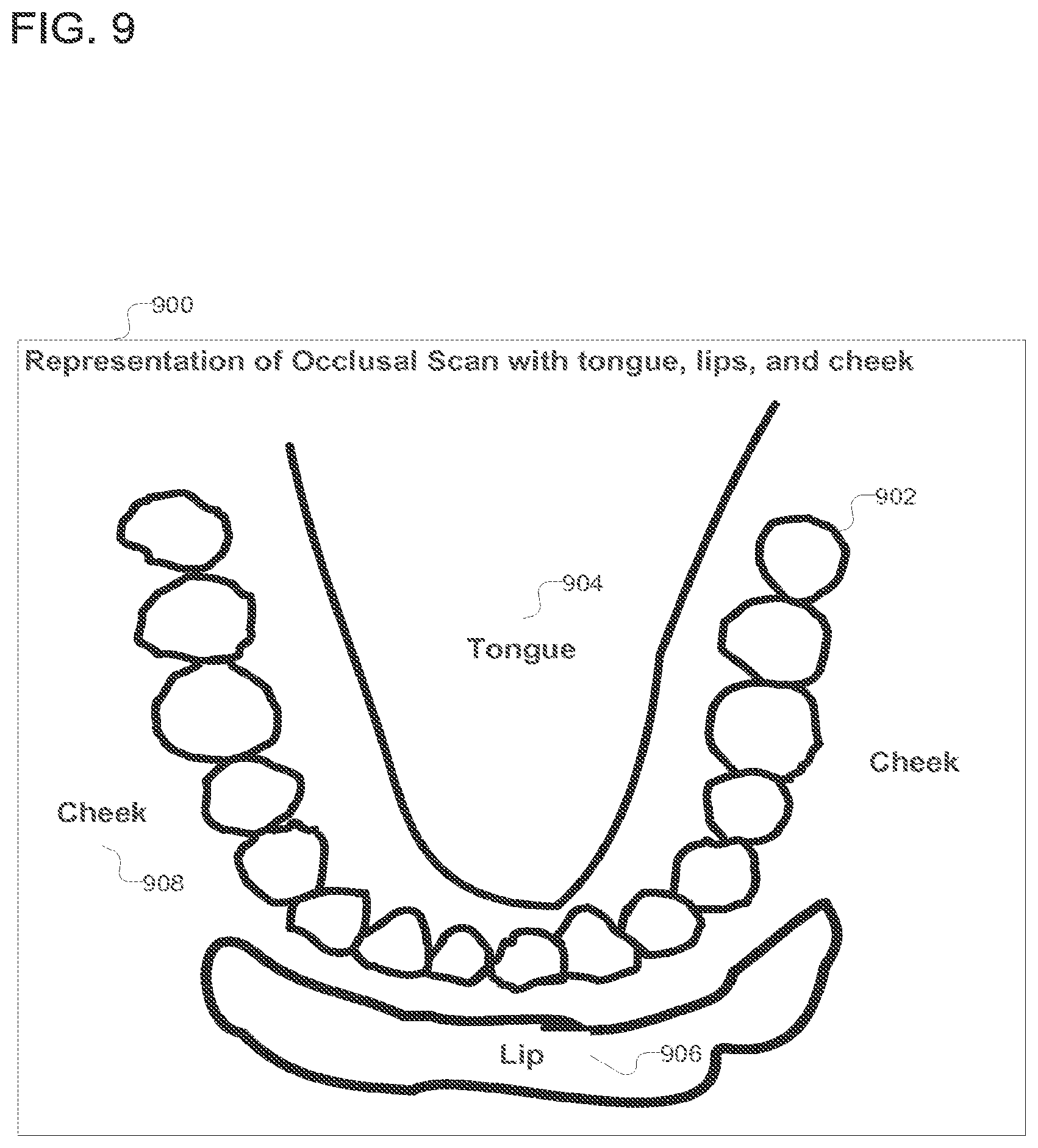 Patent US12318267 Figure 9 – Scanning sequence for an intra-oral imaging system