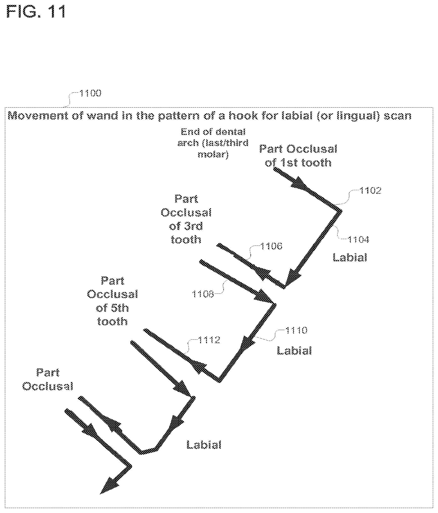 Patent US12318267 Figure 11 – Scanning sequence for an intra-oral imaging system