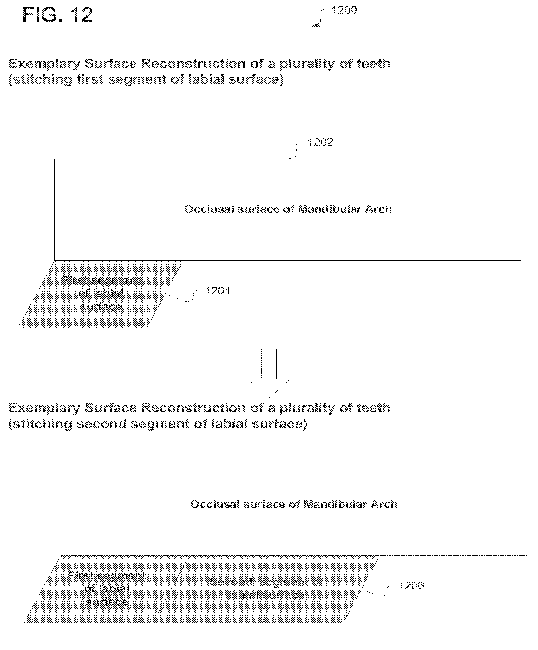 Patent US12318267 Figure 12 – Scanning sequence for an intra-oral imaging system