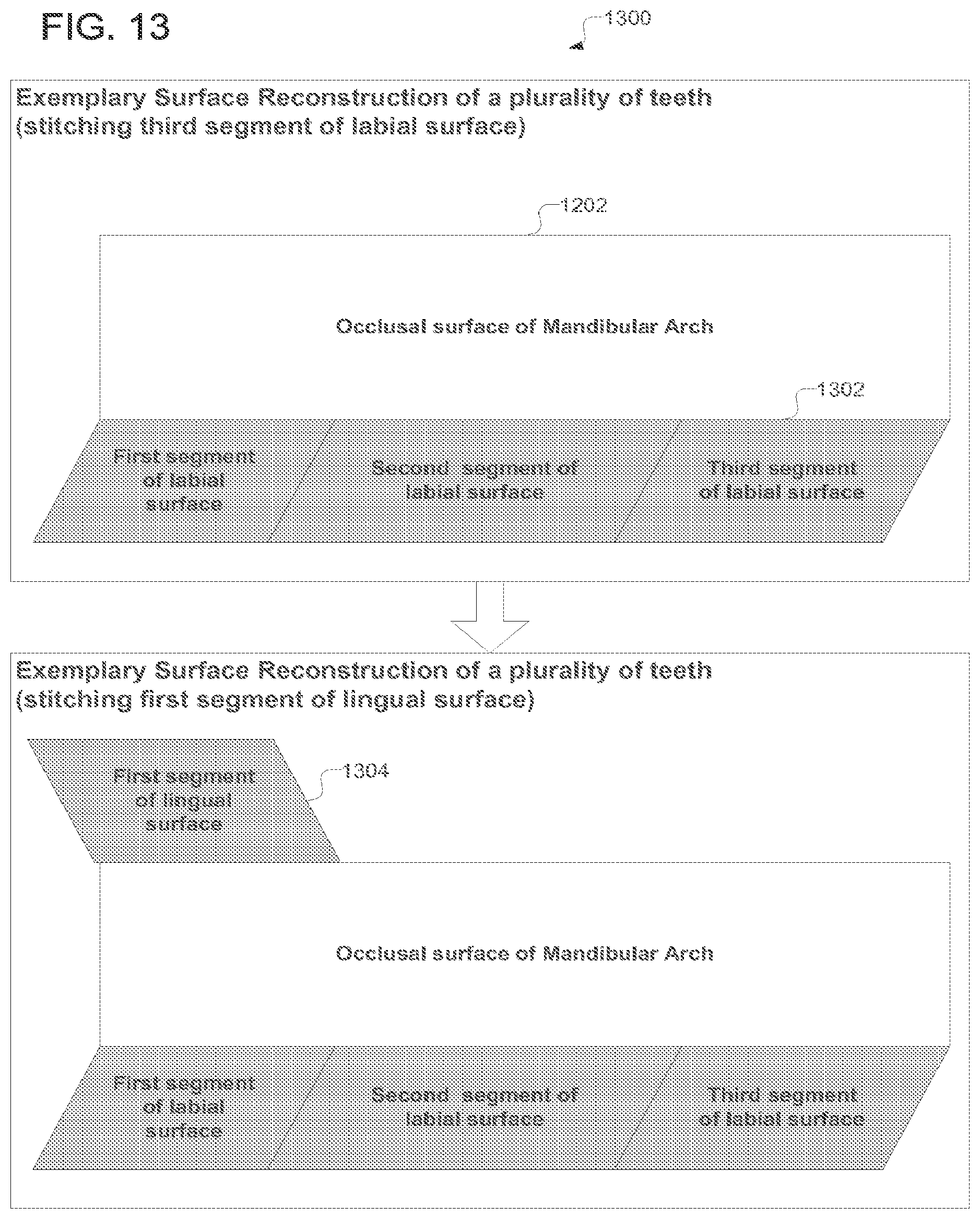 Patent US12318267 Figure 13 – Scanning sequence for an intra-oral imaging system