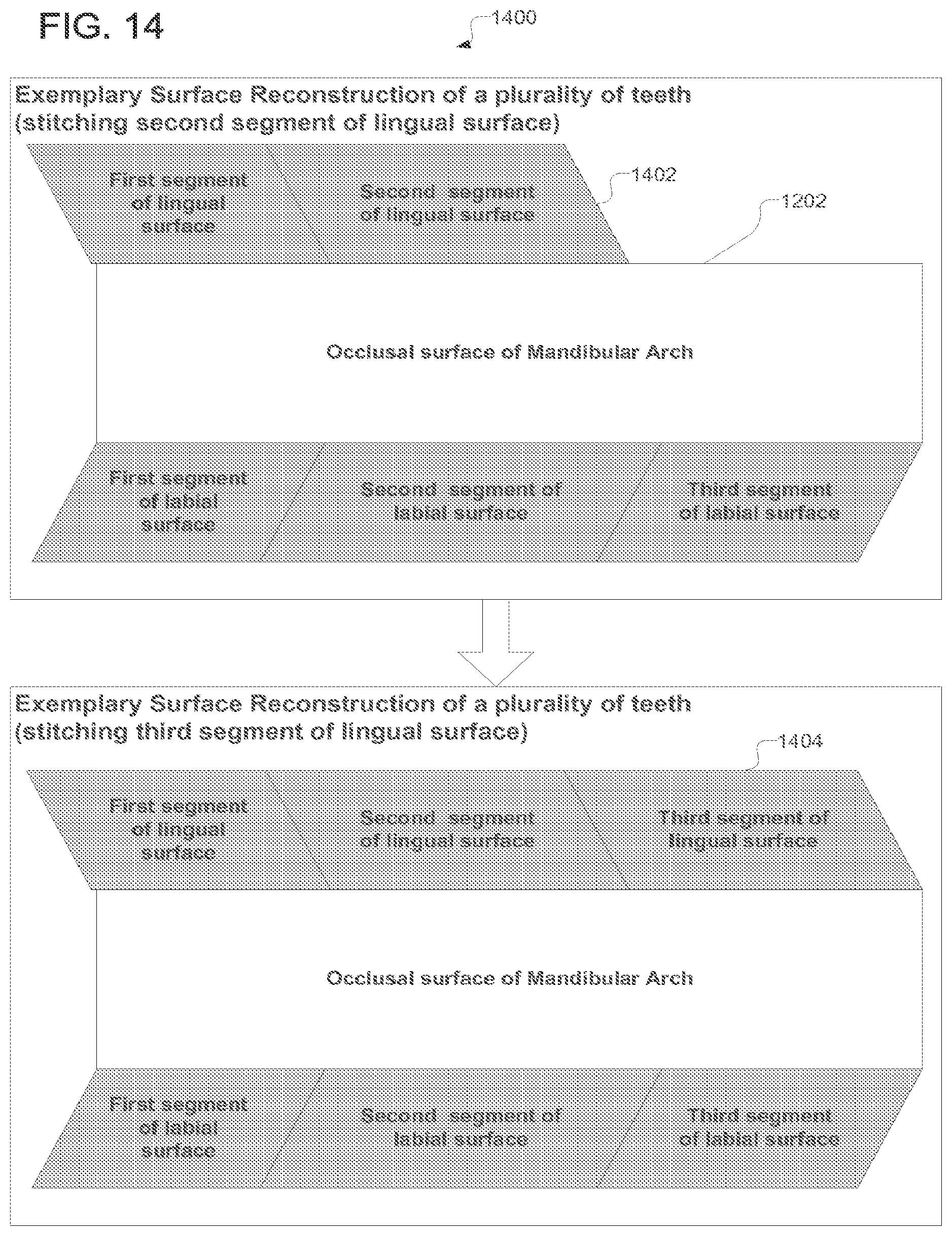 Patent US12318267 Figure 14 – Scanning sequence for an intra-oral imaging system