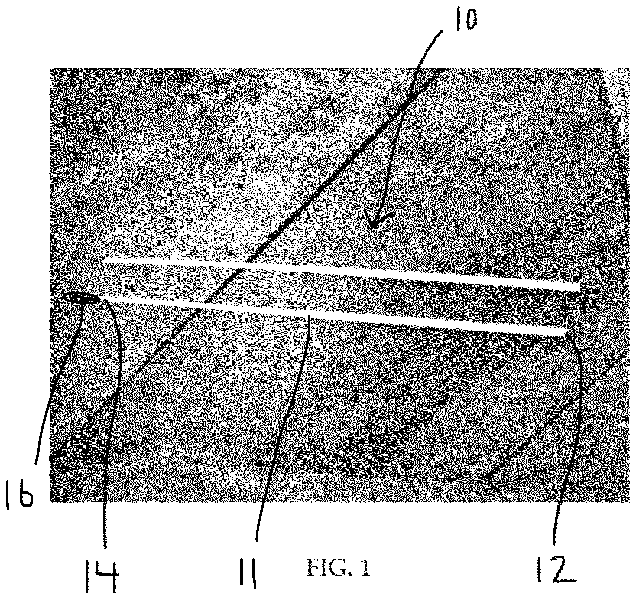 Patent US12318268 Figure 1 – Swab and method of manufacturing a swab