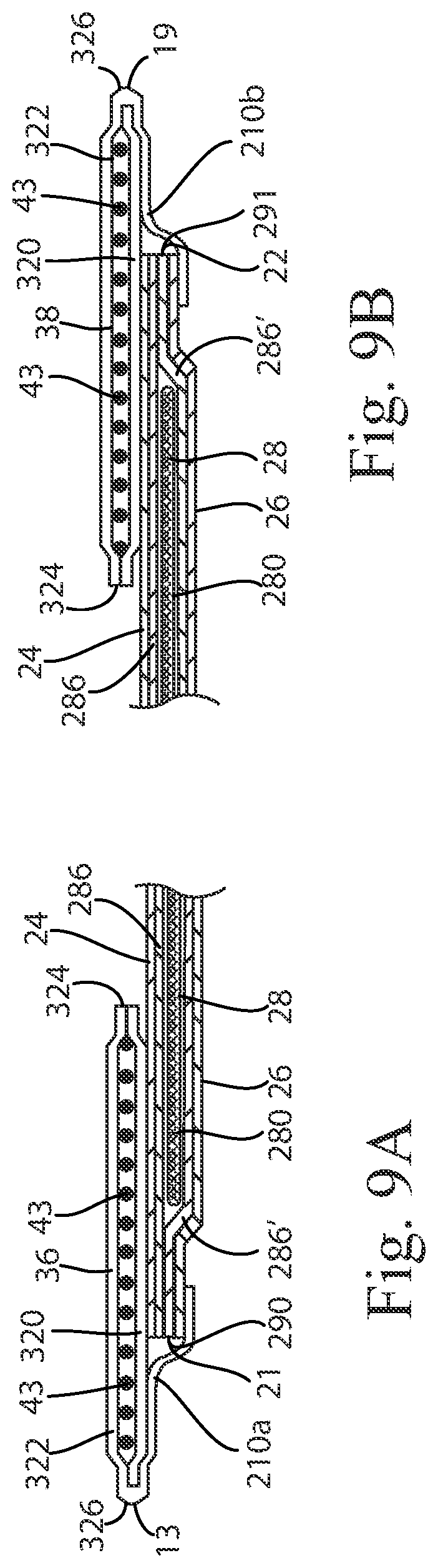 Patent US12318273 Figure 8 – Absorbent article with absorbent core