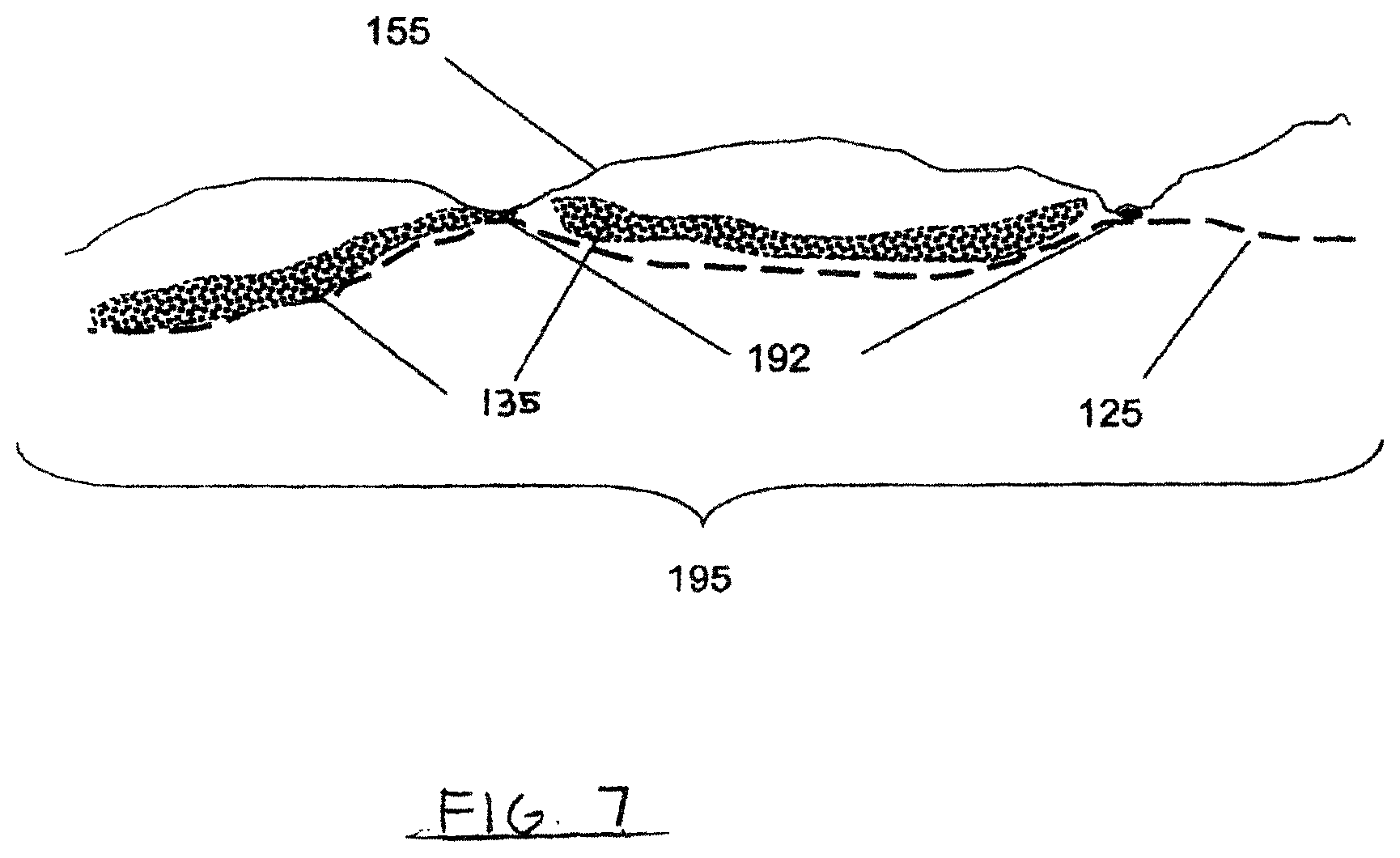 Patent US12318274 Figure 6 – Method of making an absorbent composite
