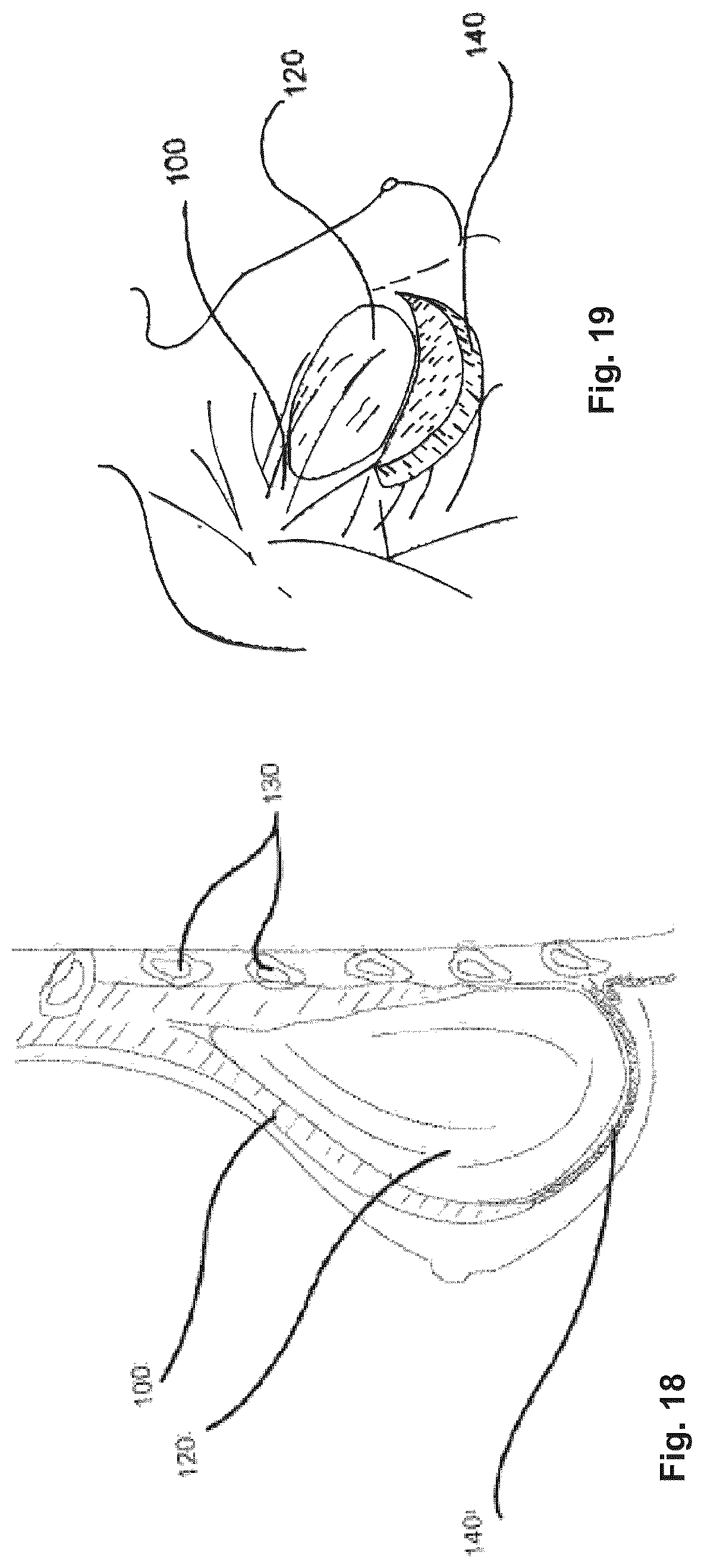 Patent US12318275 Figure 9 – Surgical attachment device