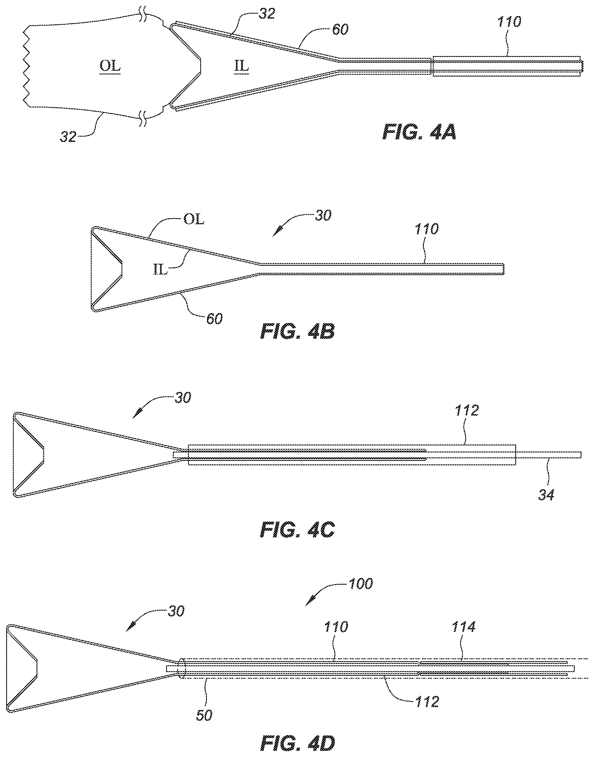 Patent US12318277 Figure 2 – Apparatus and methods for retrieving a foreign body from a vasculature