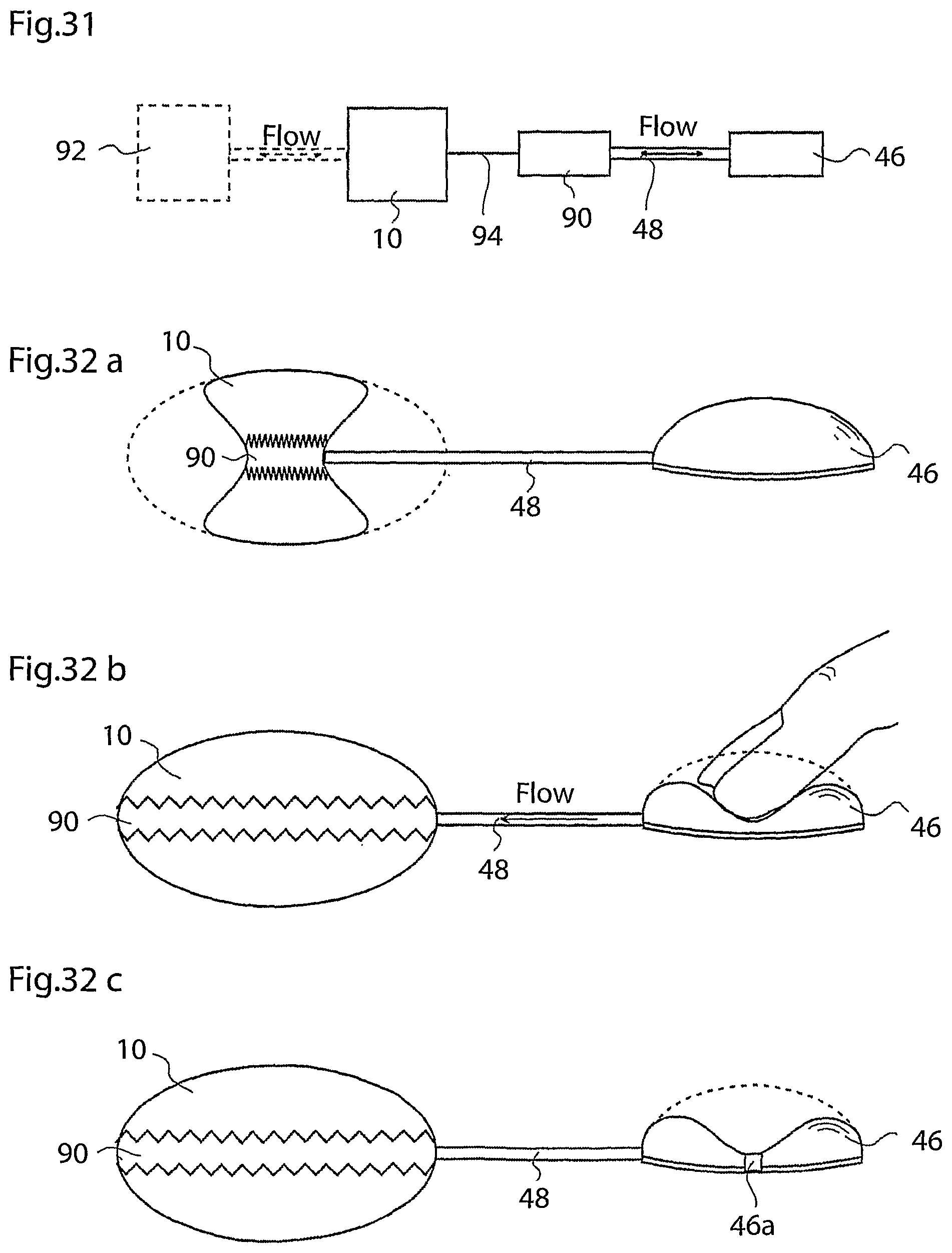 Patent US12318278 Figure 15 – Methods and instruments for treating GERD and hiatal hernia