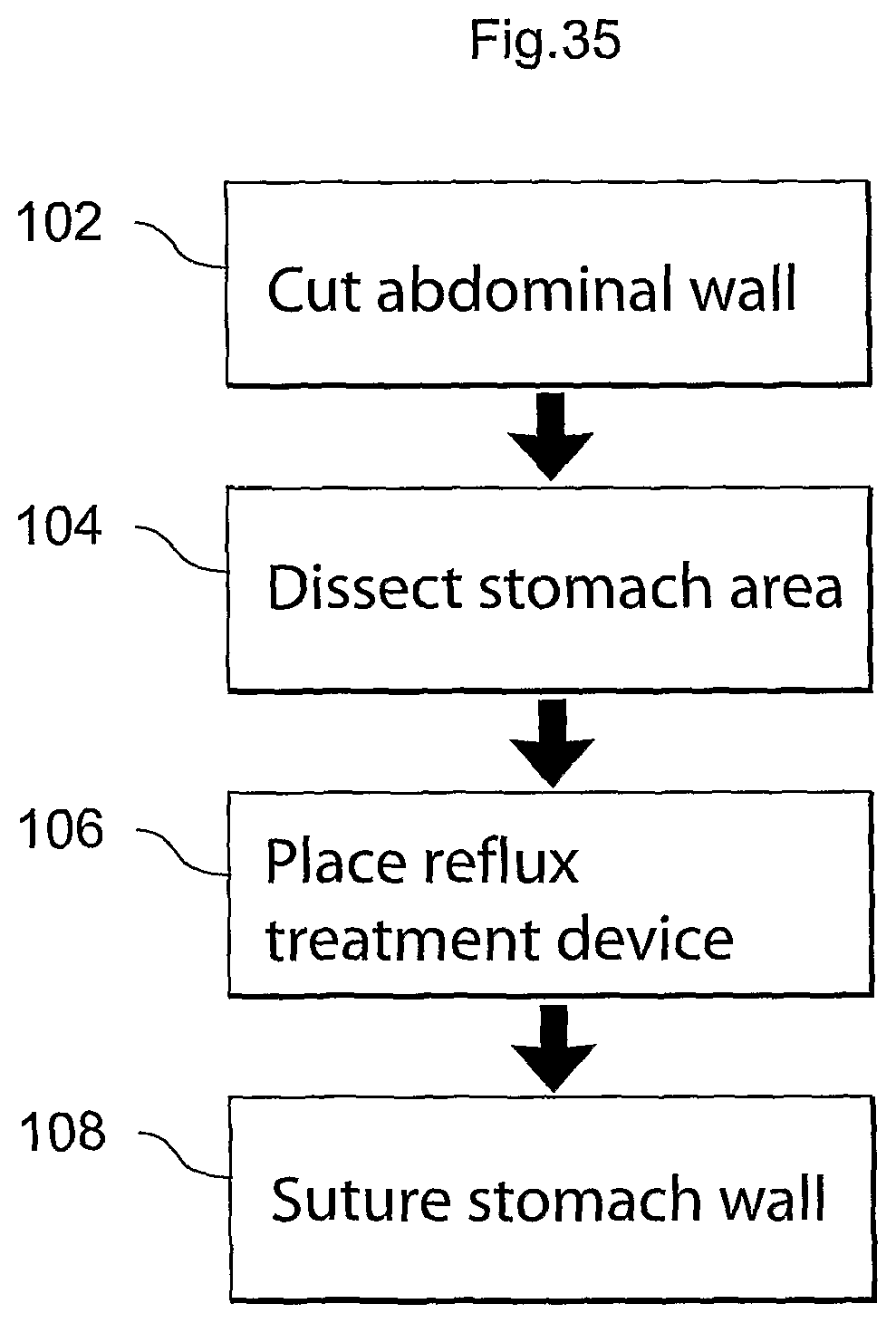 Patent US12318278 Figure 17 – Methods and instruments for treating GERD and hiatal hernia