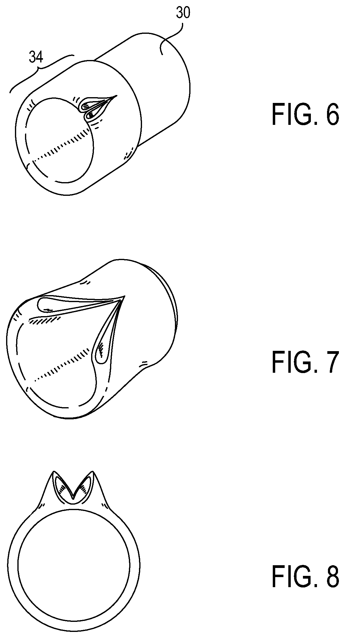 Patent US12318279 Figure 5 – Lens delivery system
