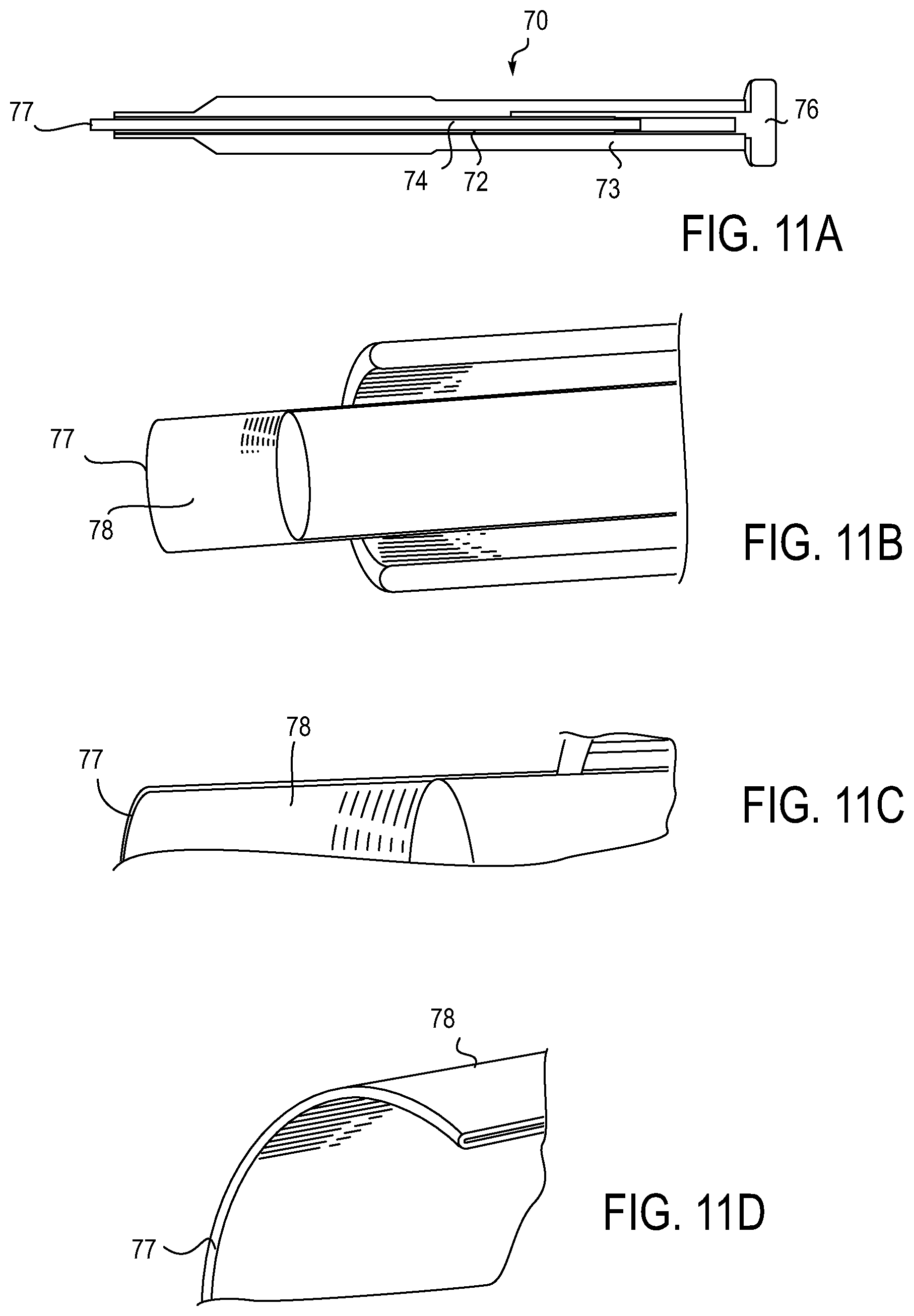 Patent US12318279 Figure 7 – Lens delivery system