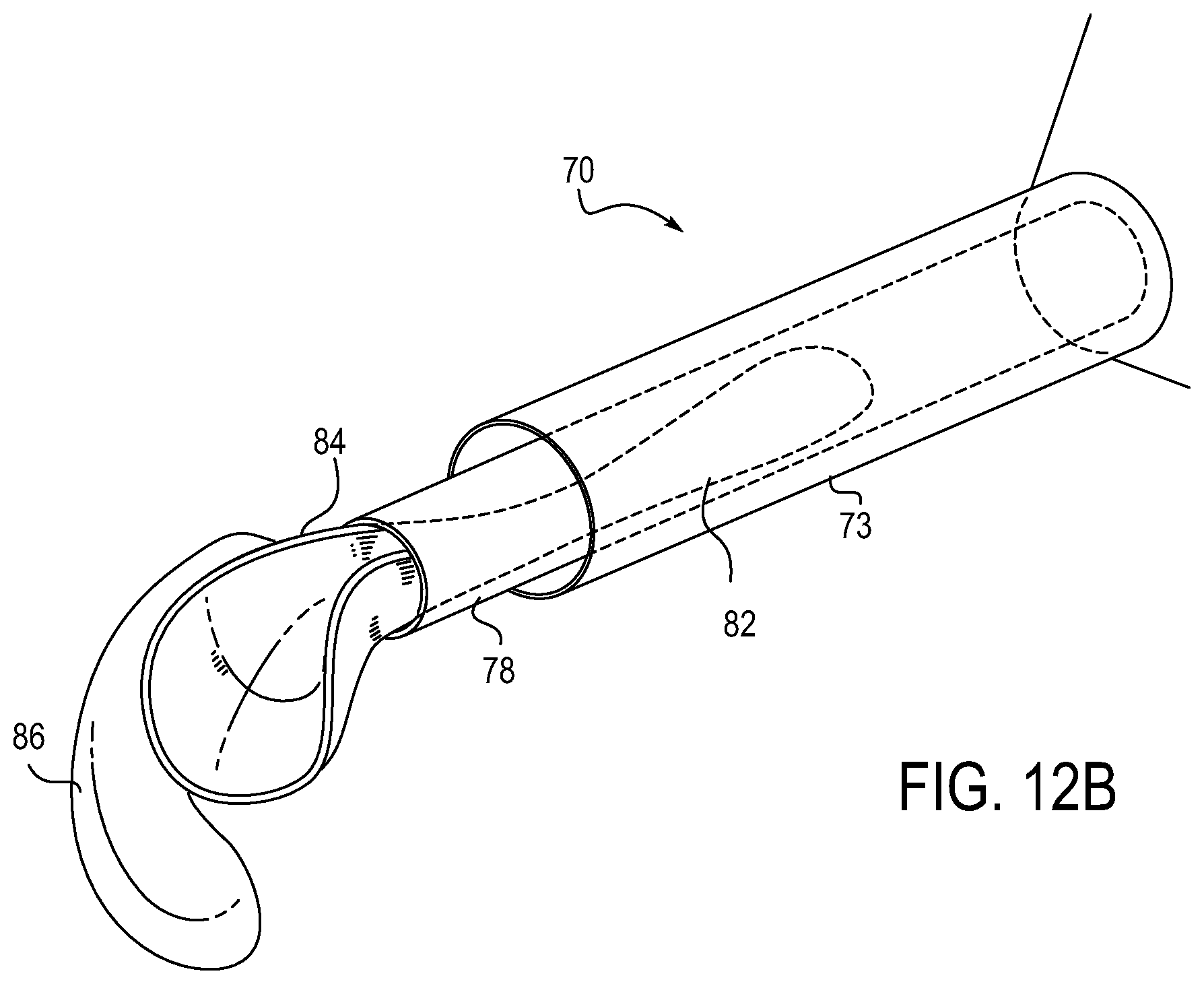 Patent US12318279 Figure 9 – Lens delivery system
