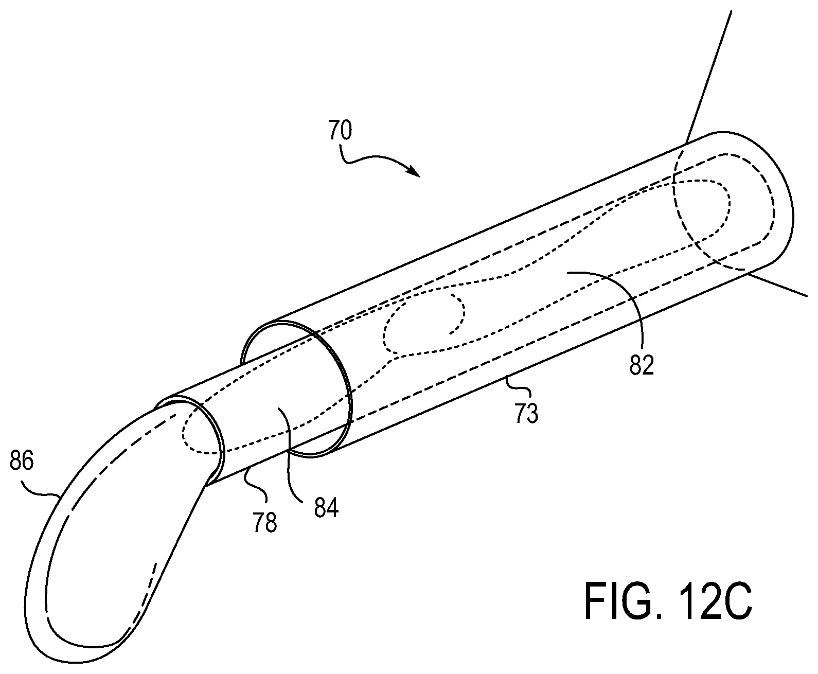 Patent US12318279 Figure 10 – Lens delivery system