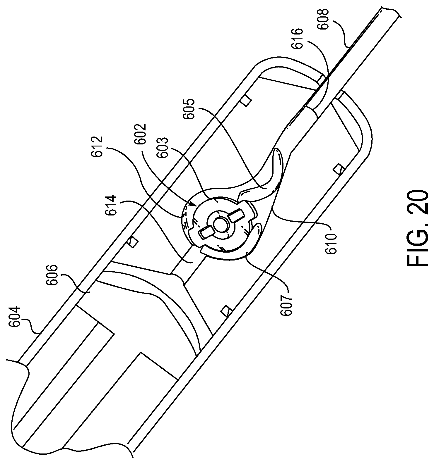 Patent US12318279 Figure 18 – Lens delivery system