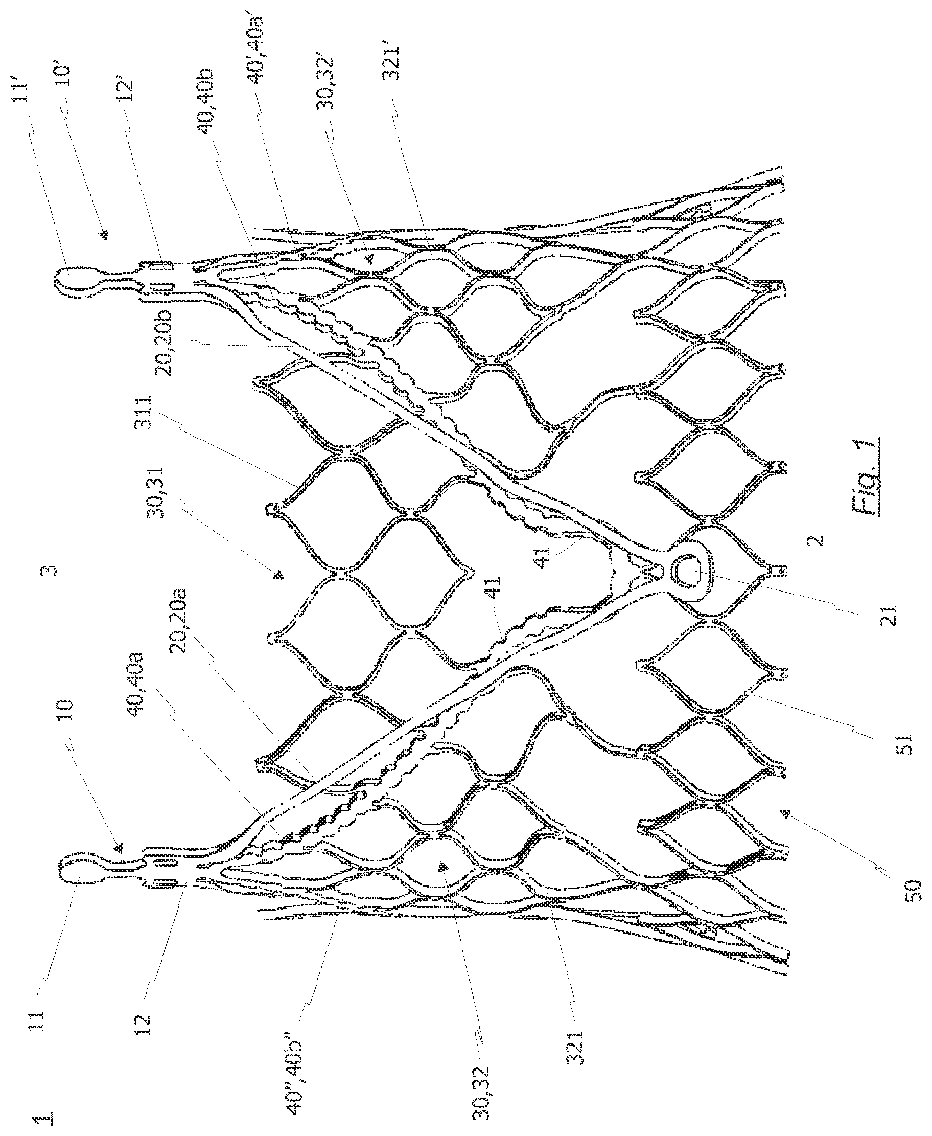 Patent US12318281 Figure 1 – Radially collapsible frame for a prosthetic valve and method for manufacturing such a frame