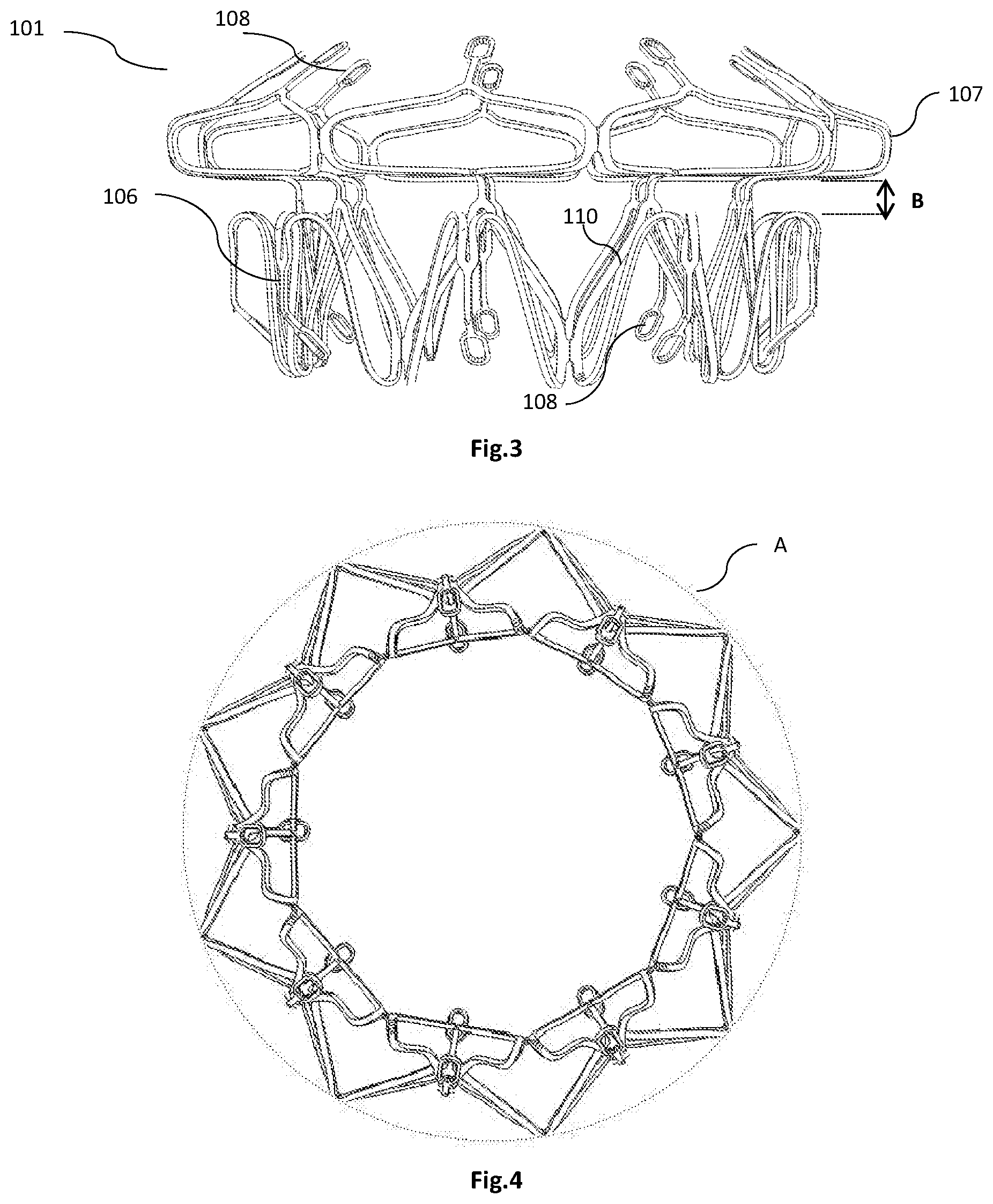 Patent US12318282 Figure 2 – Transapical implantable mitral valve device