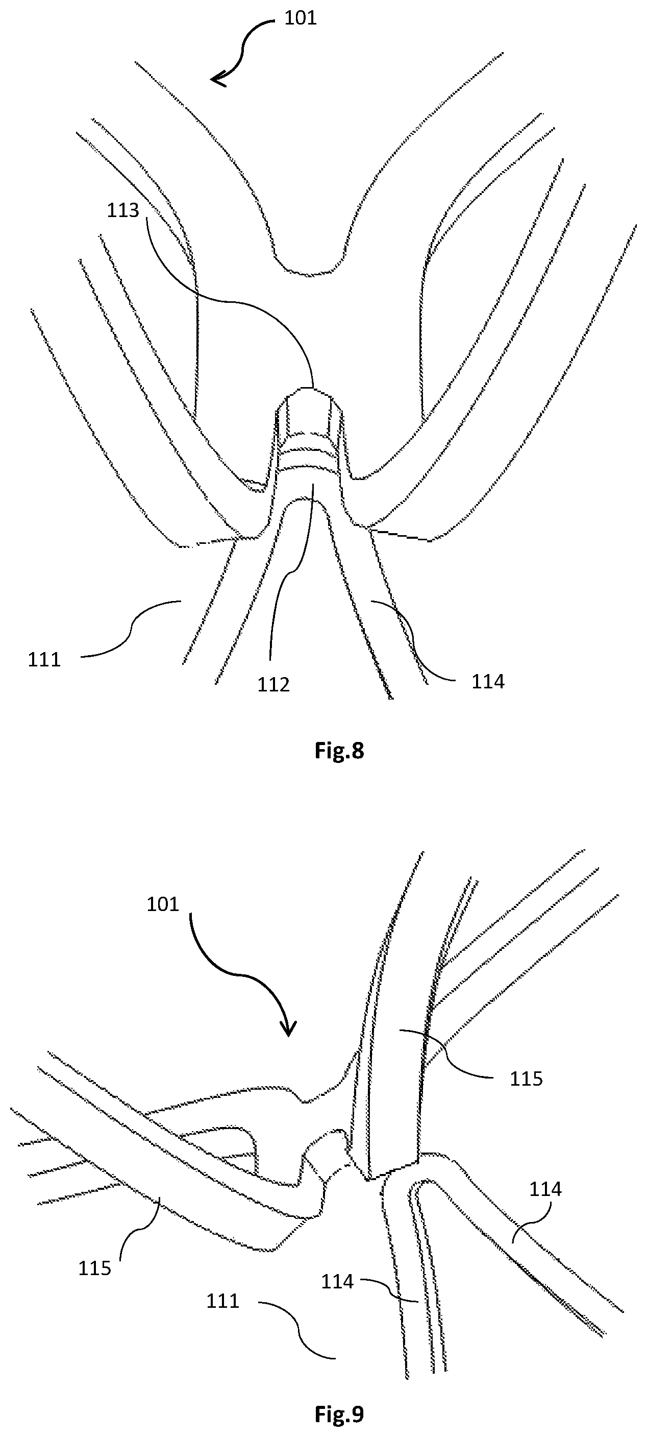 Patent US12318282 Figure 6 – Transapical implantable mitral valve device
