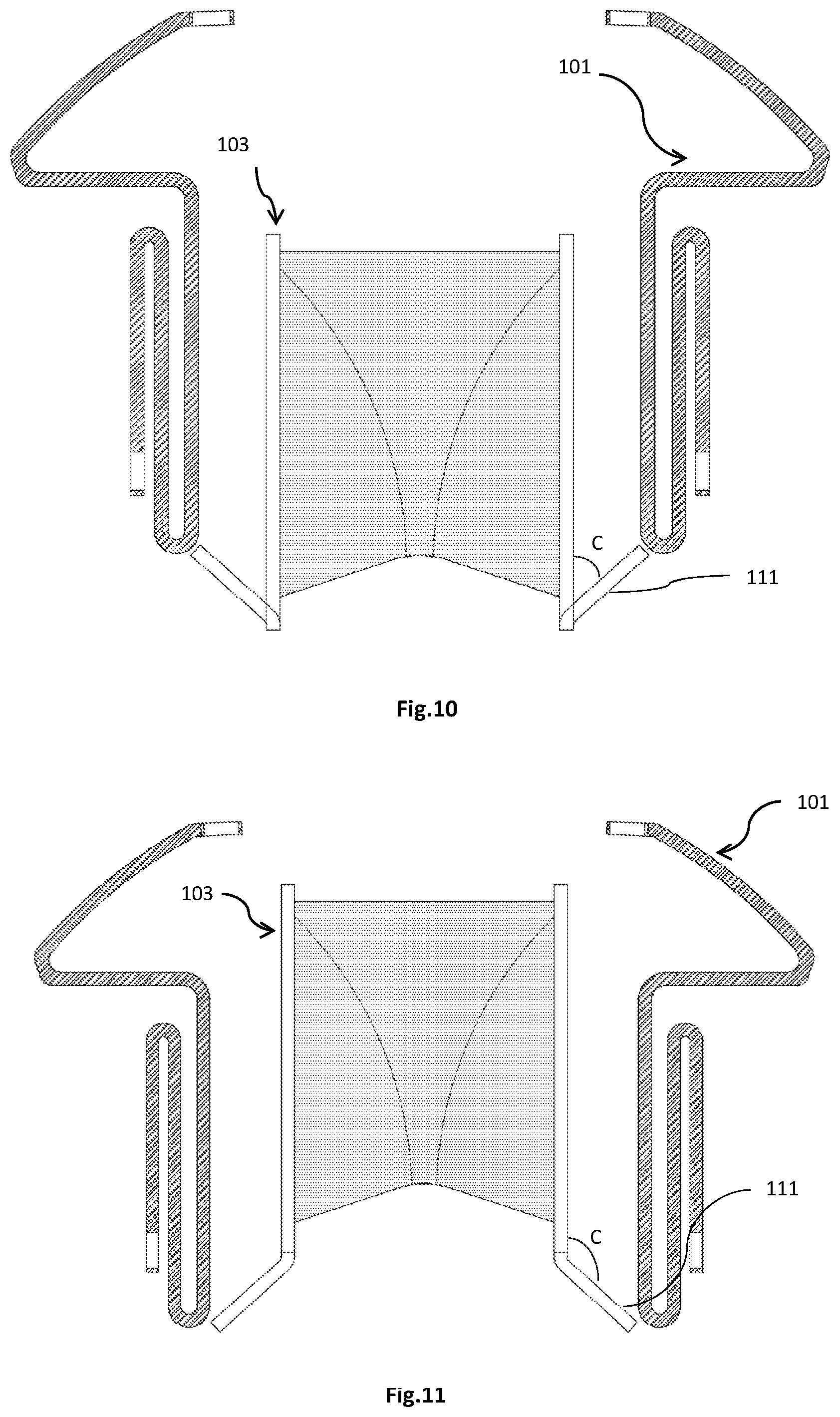 Patent US12318282 Figure 7 – Transapical implantable mitral valve device